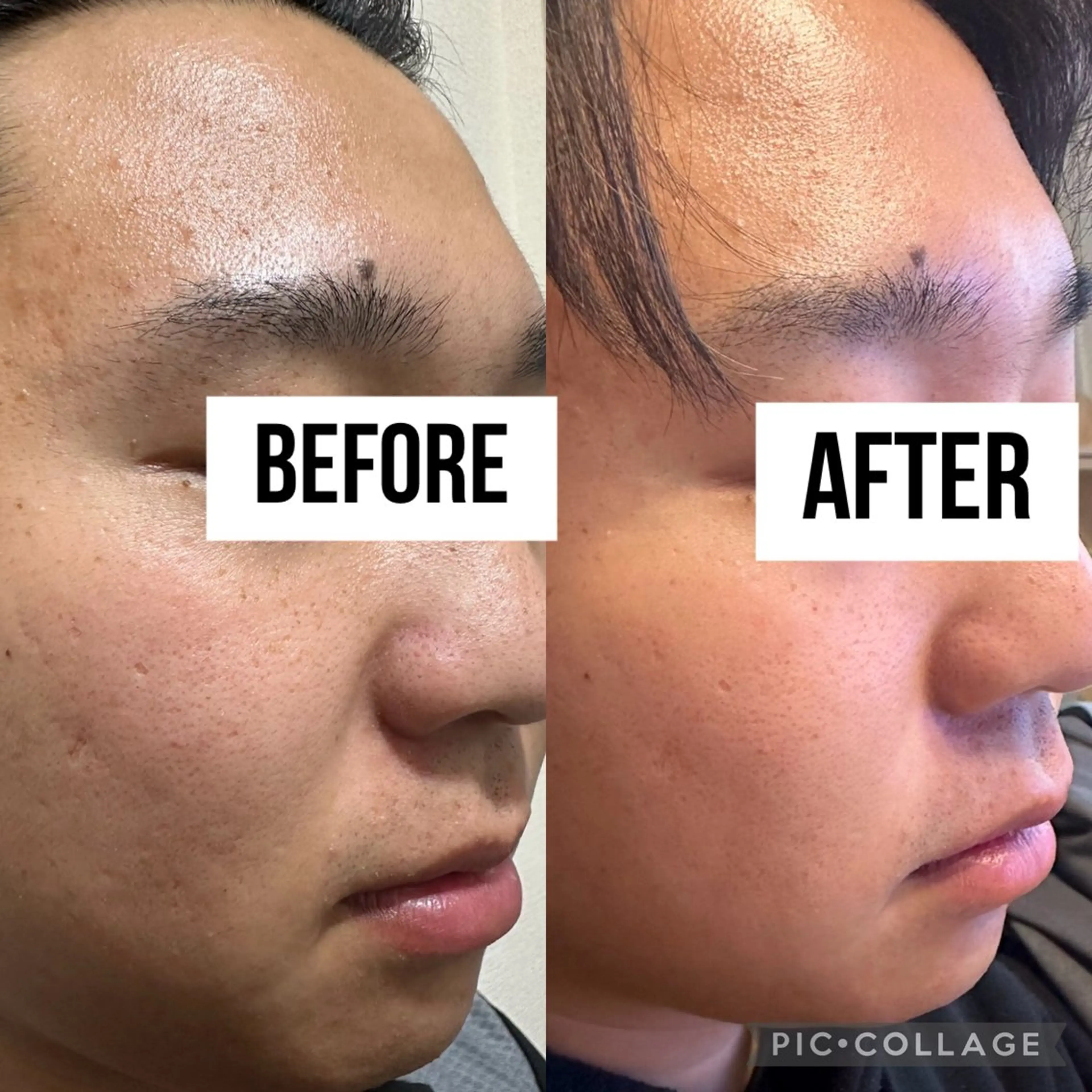 自爪育成× 肌質改善サロンのネイルデザイン