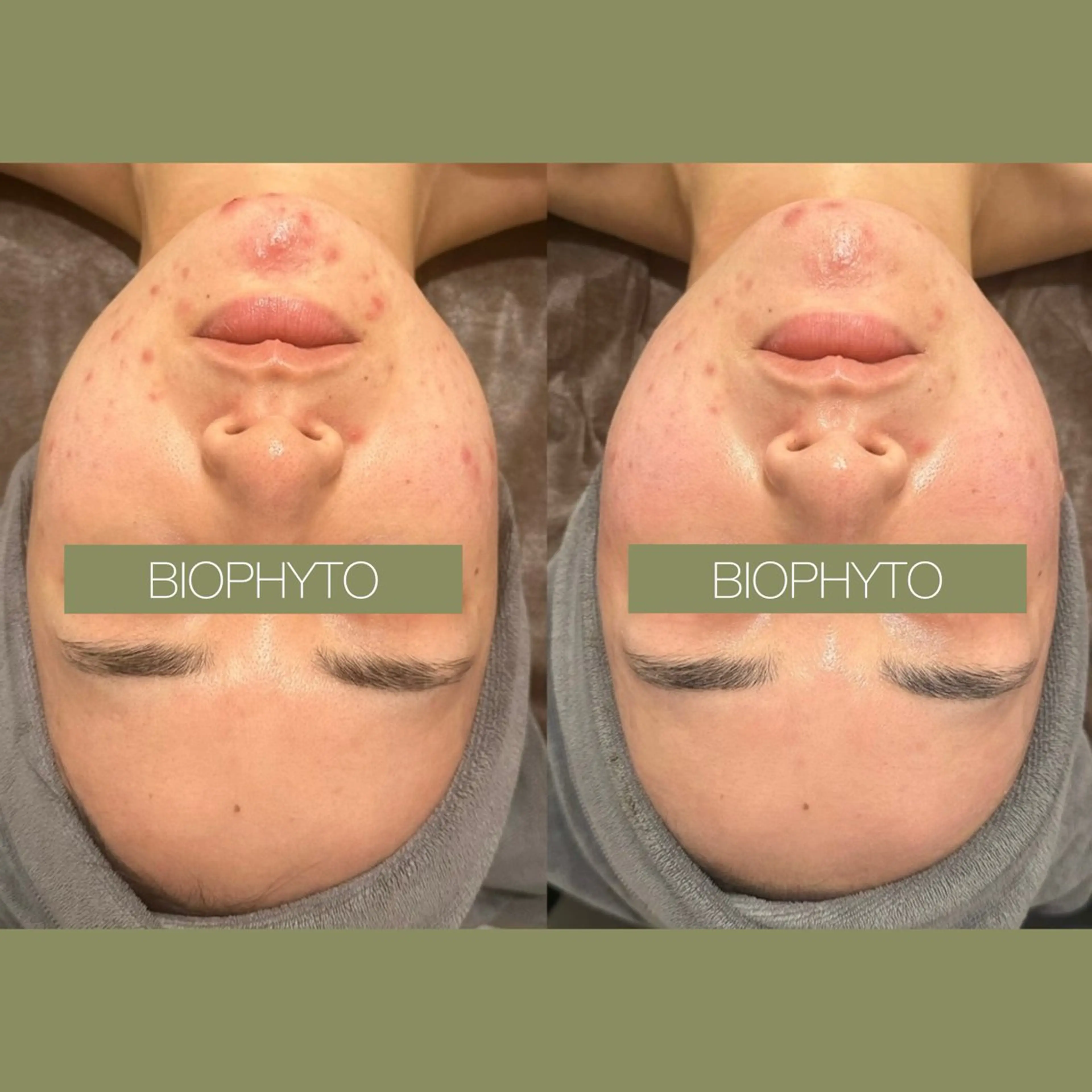 小顔コルギ ☆表参道/外苑前のエステ・リラクイメージ