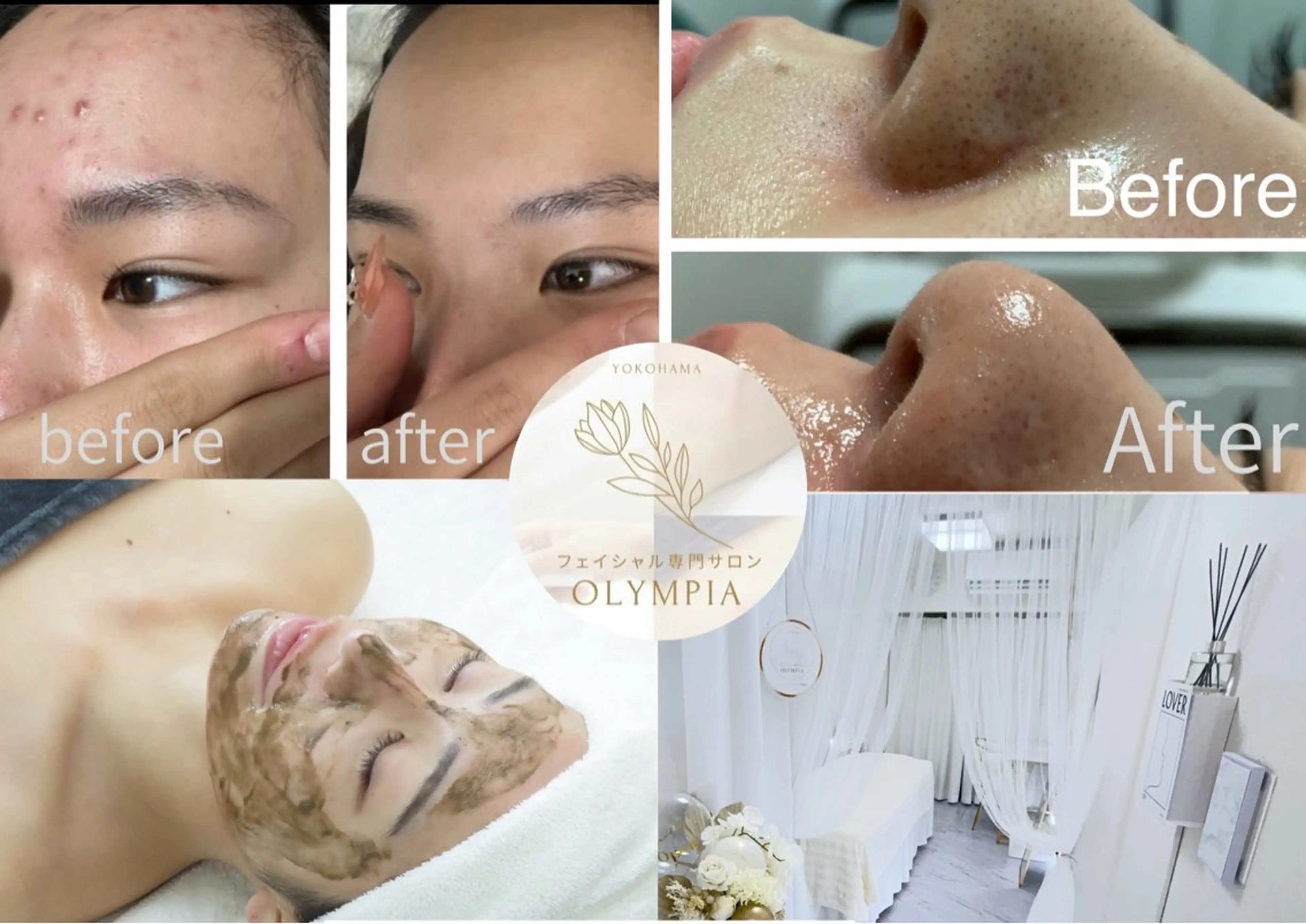 OLYMPIA 小顔 ハーブピーリングのエステ・リラクイメージ