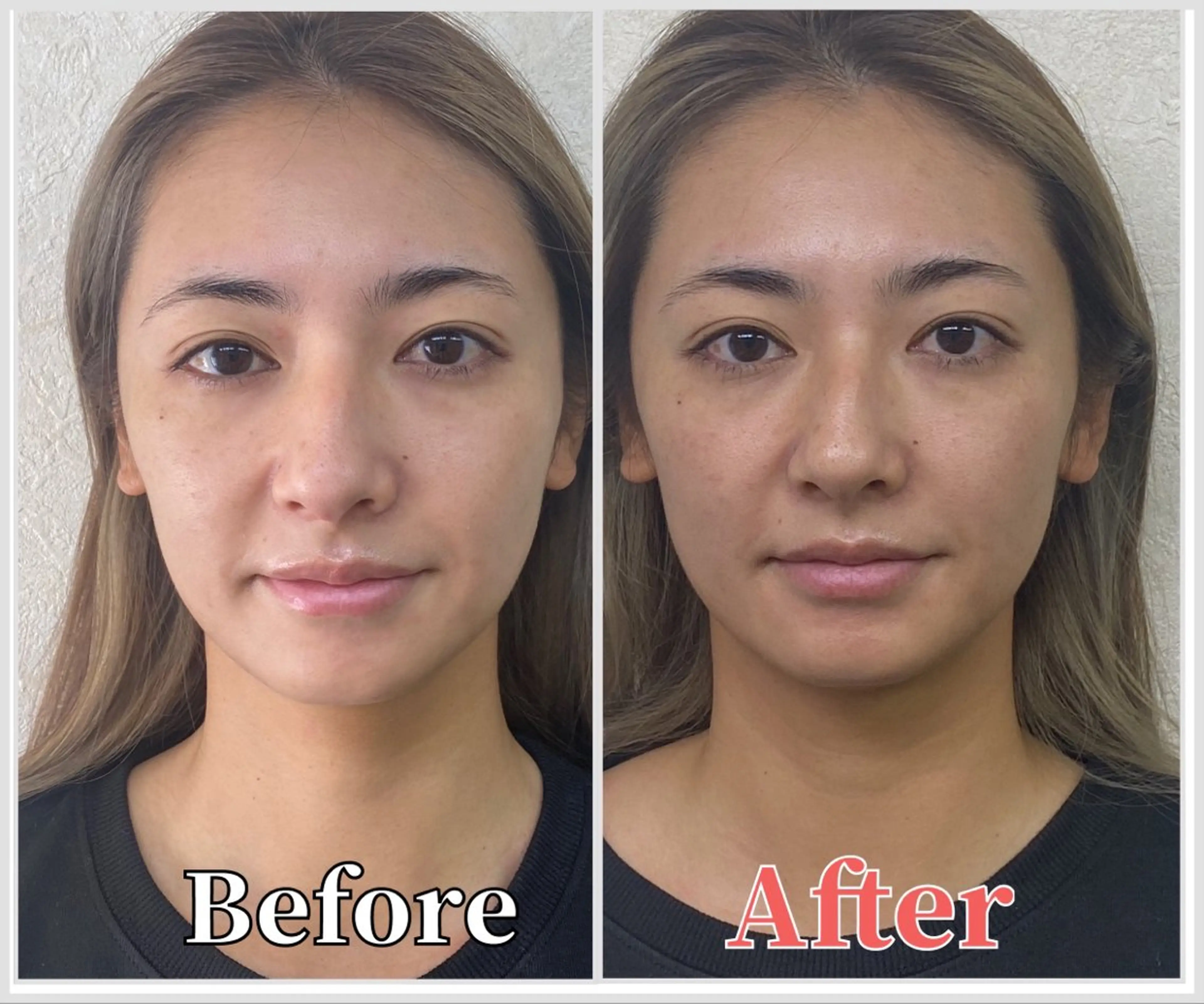 整体 LALUZ中目黒のその他イメージ