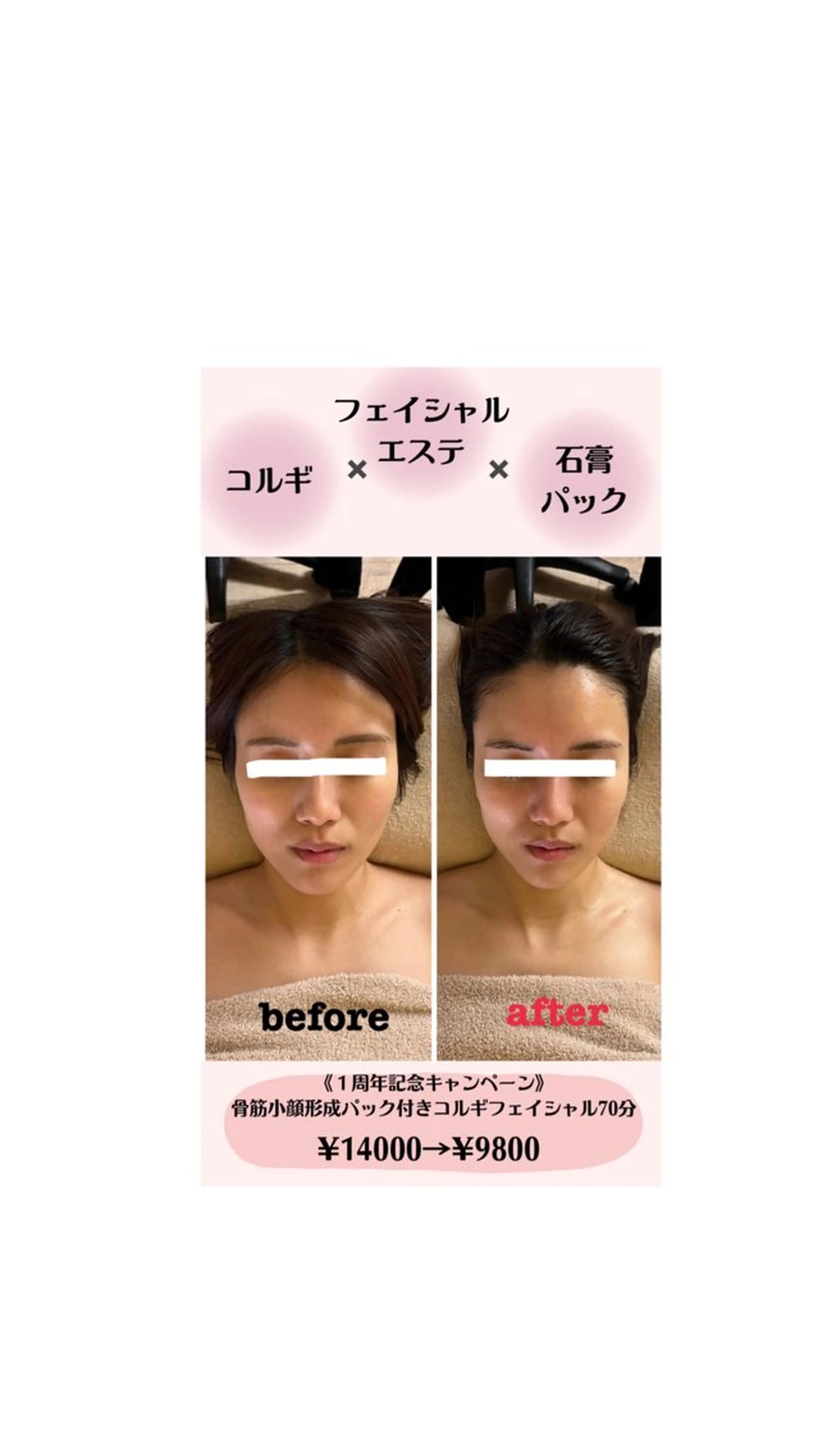 コルギ＆リラクゼーション　Acorde所属・小顔・巻肩・猫背ケア コルギ　Acordeのエステ・リラクイメージ