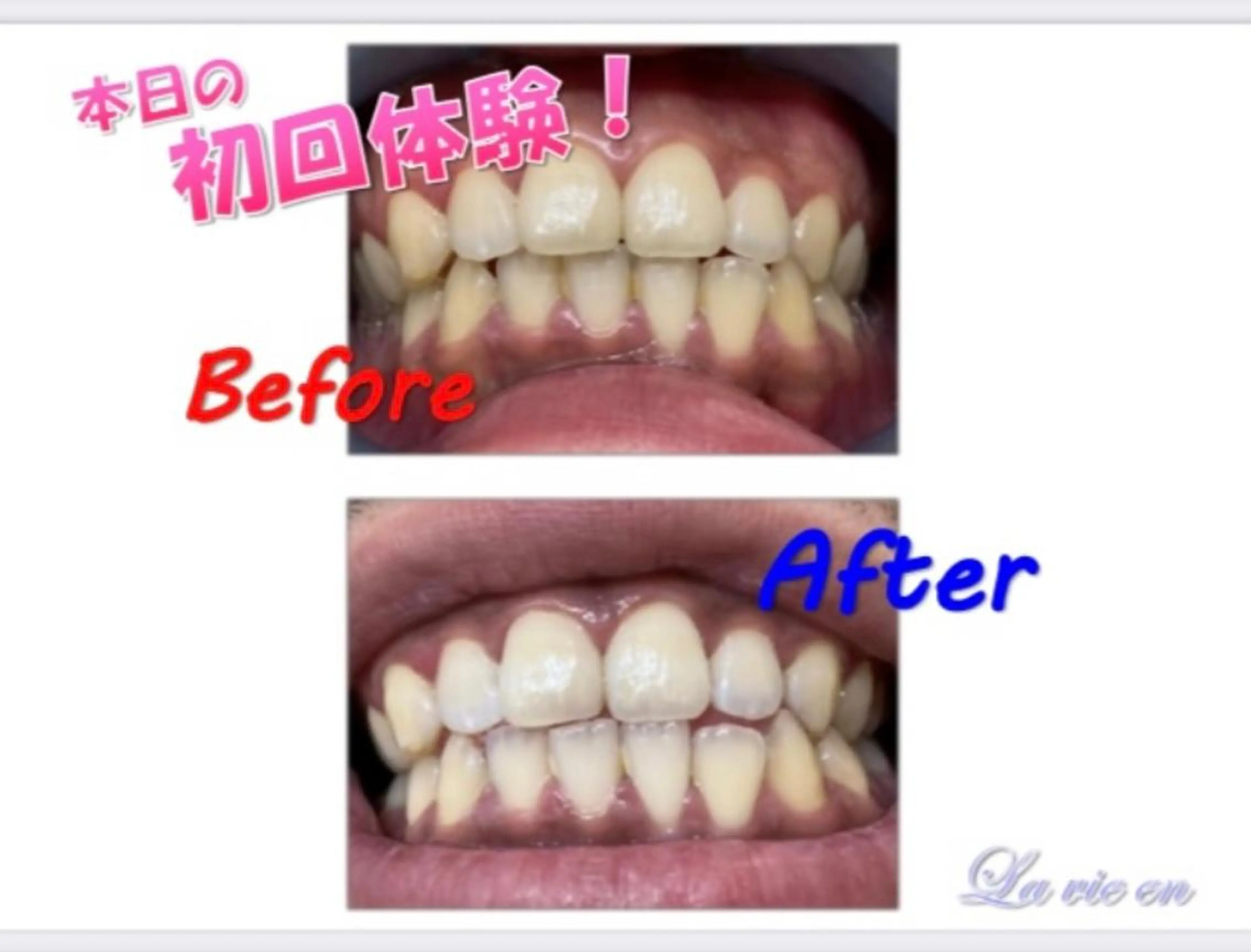 その他 ホワイトニングサロン La vie enのその他イメージ