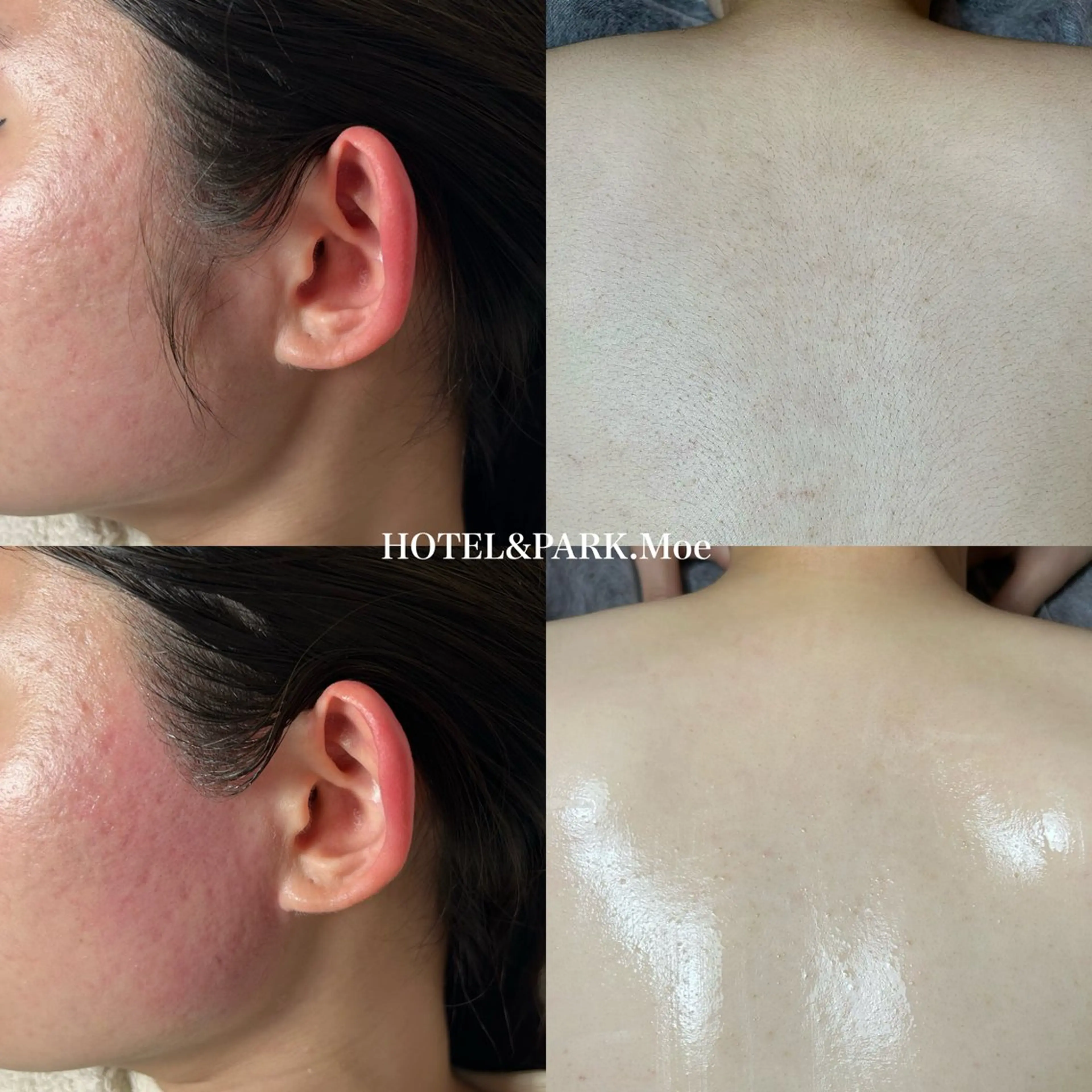 HOTEL&PARK .Moeワックス脱毛のエステ・リラクイメージ