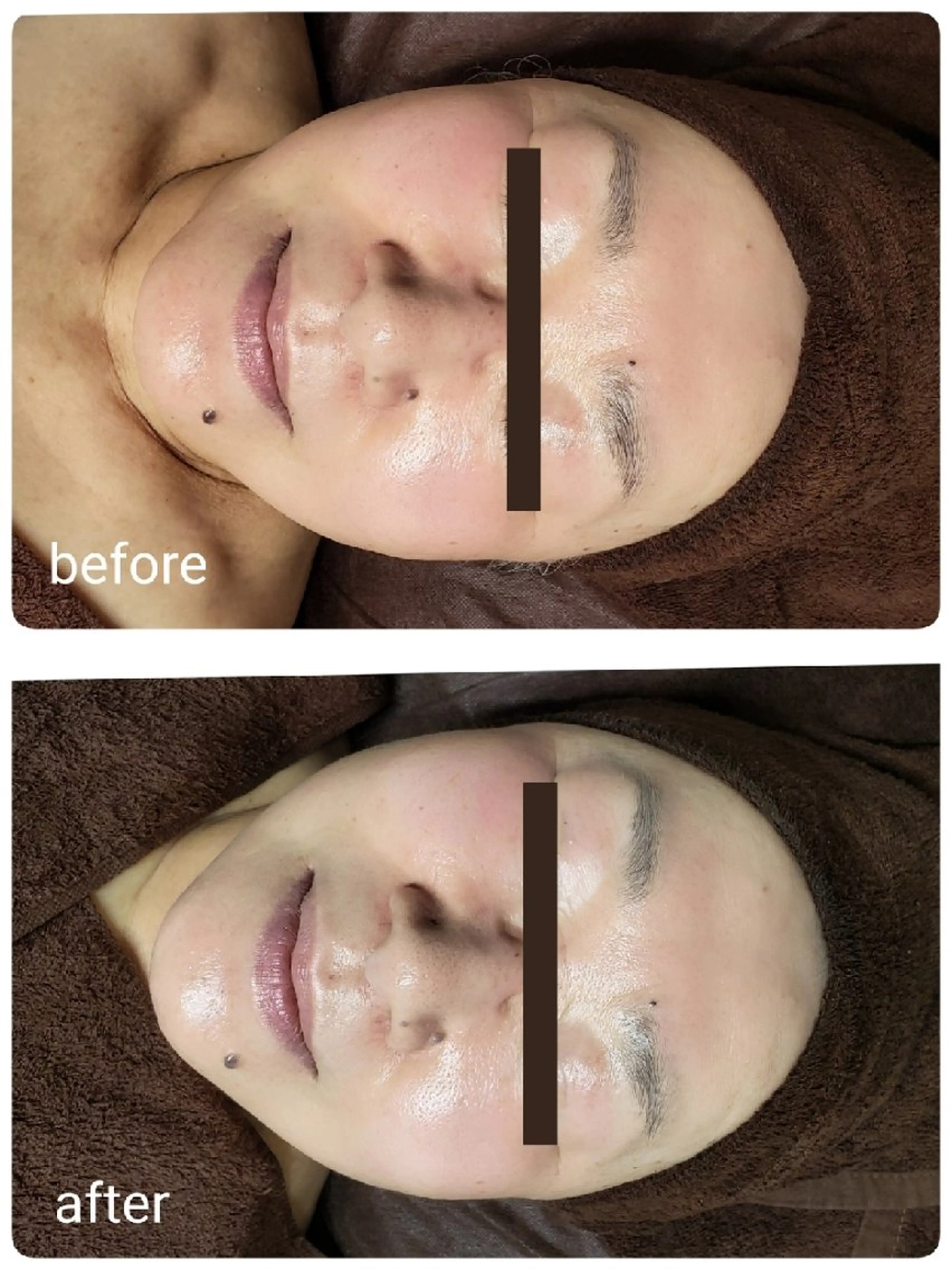 エステ 肌悩み解決サロン ハーブピーリングのエステ・リラクイメージ