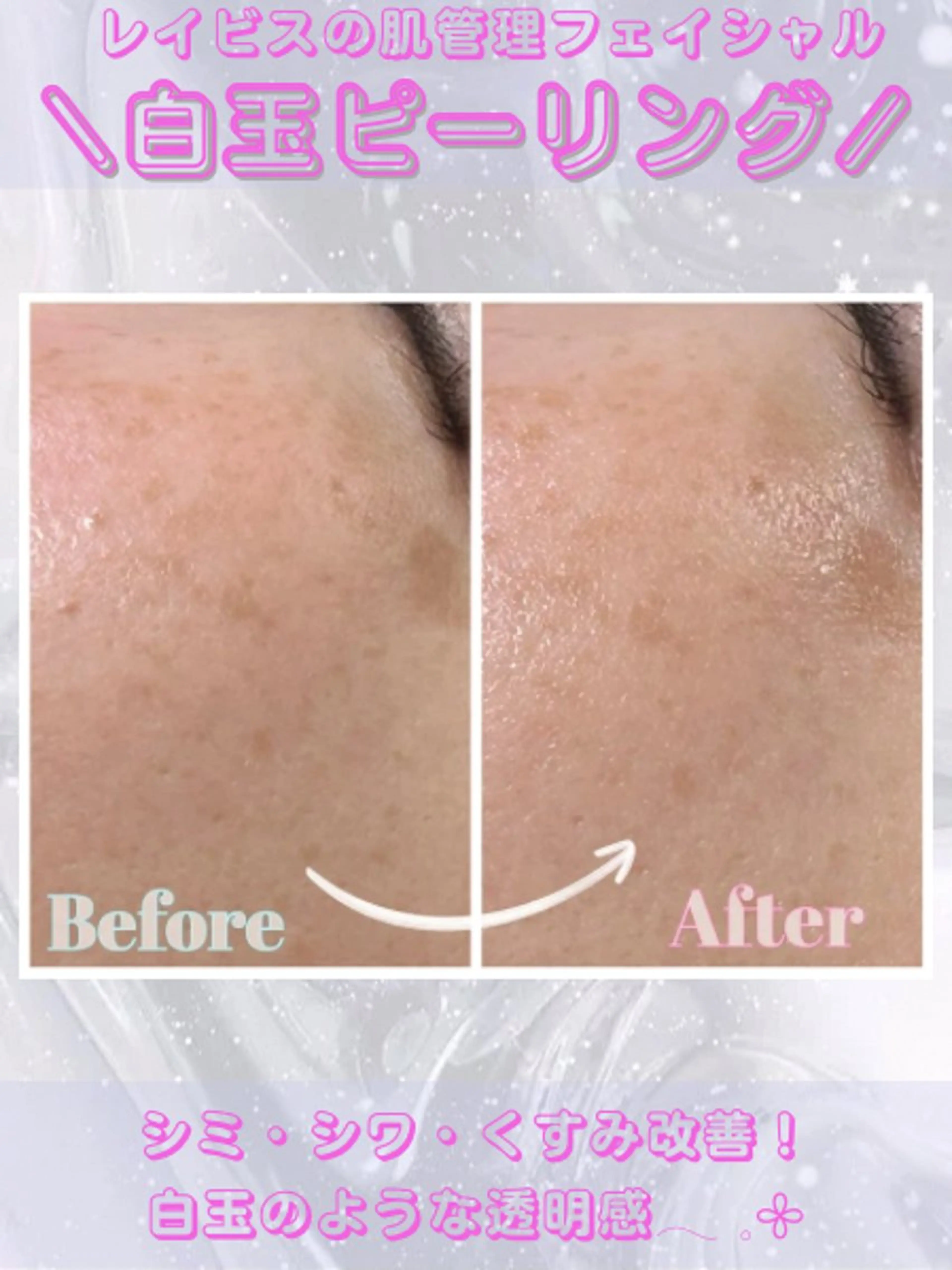 エステ レイビス盛岡店 ♡吉田♡のエステ・リラクイメージ