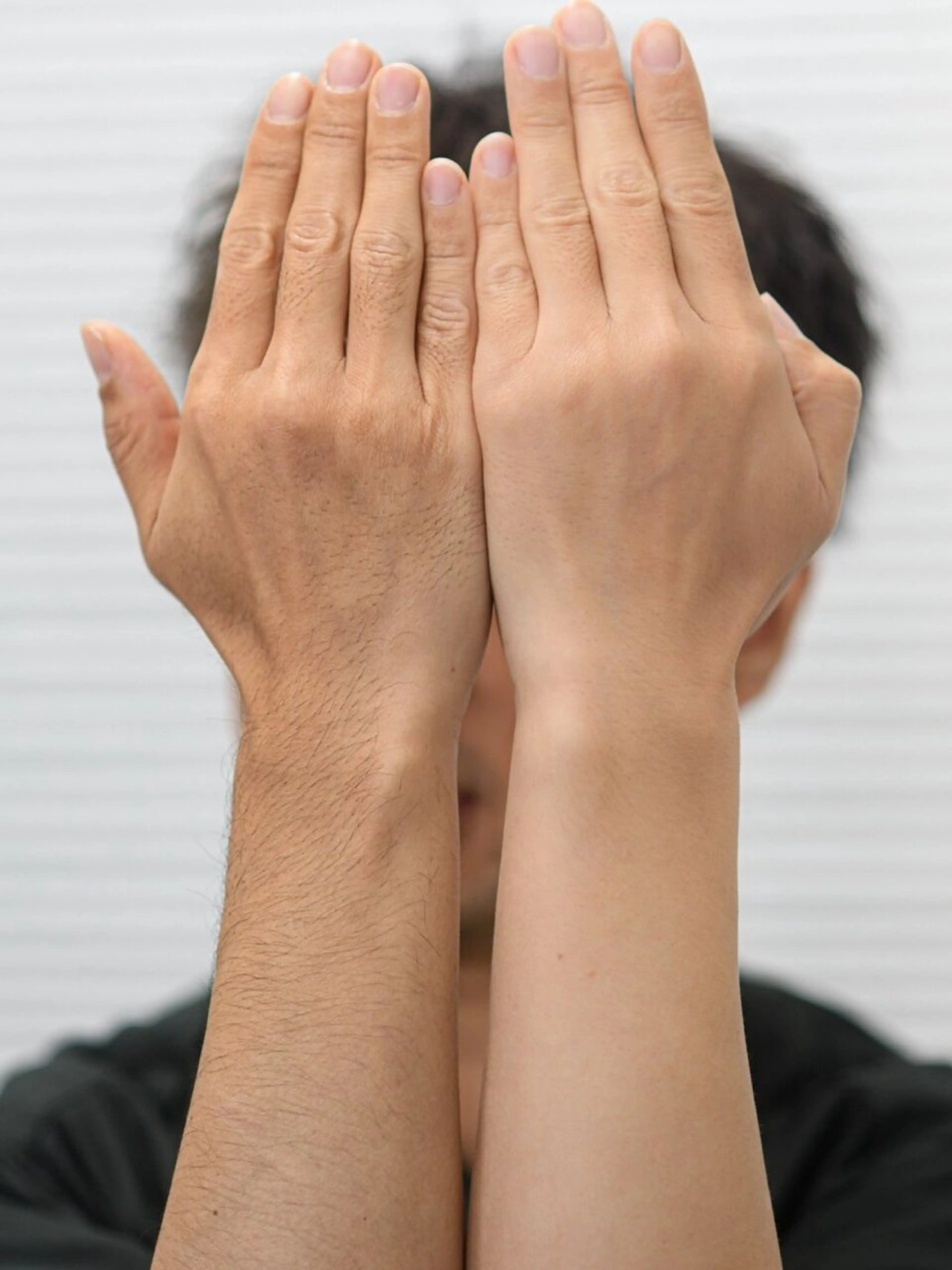 男性腕まるごと脱毛メンズの写真