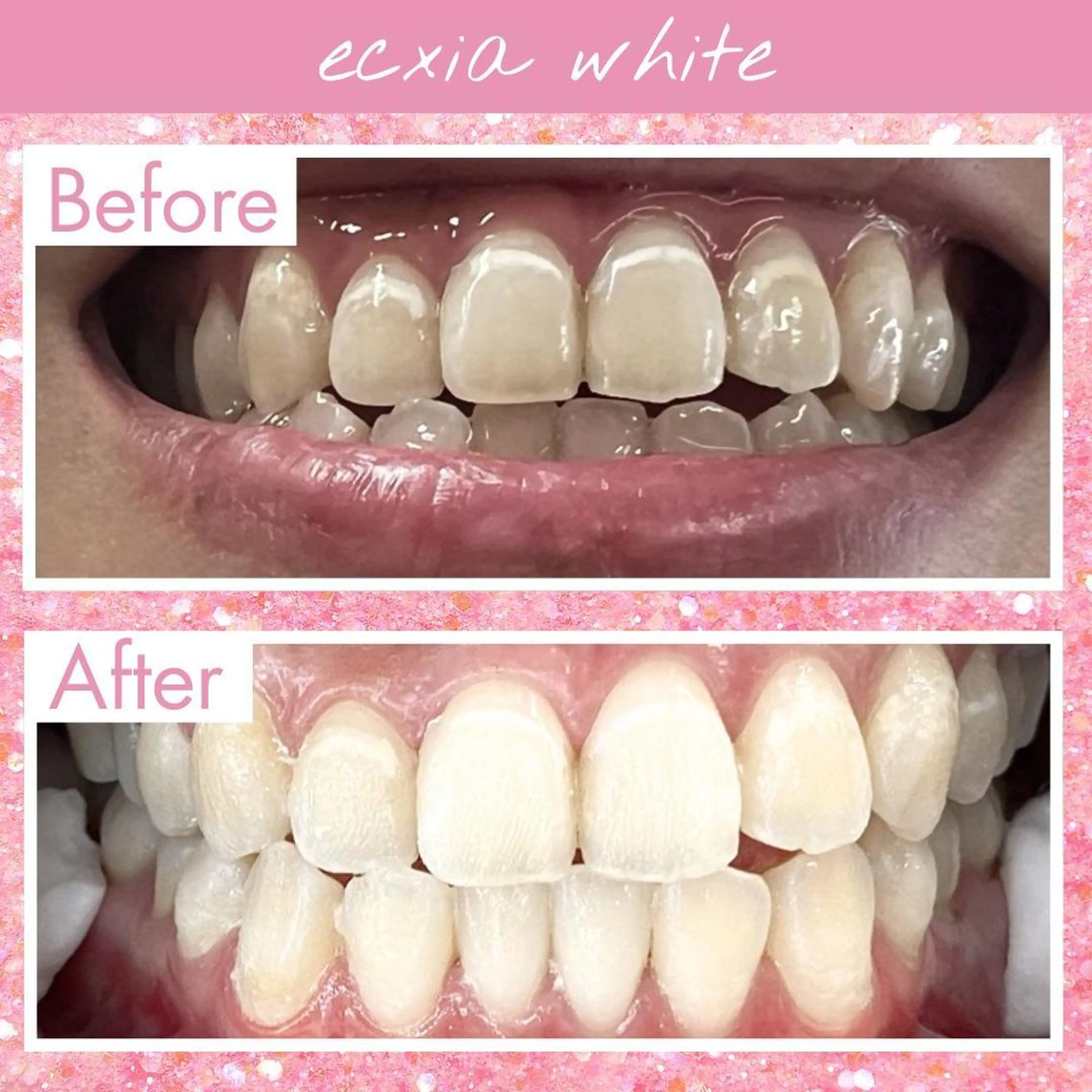 その他 セルフホワイトニング エクシア大阪梅田店のその他イメージ