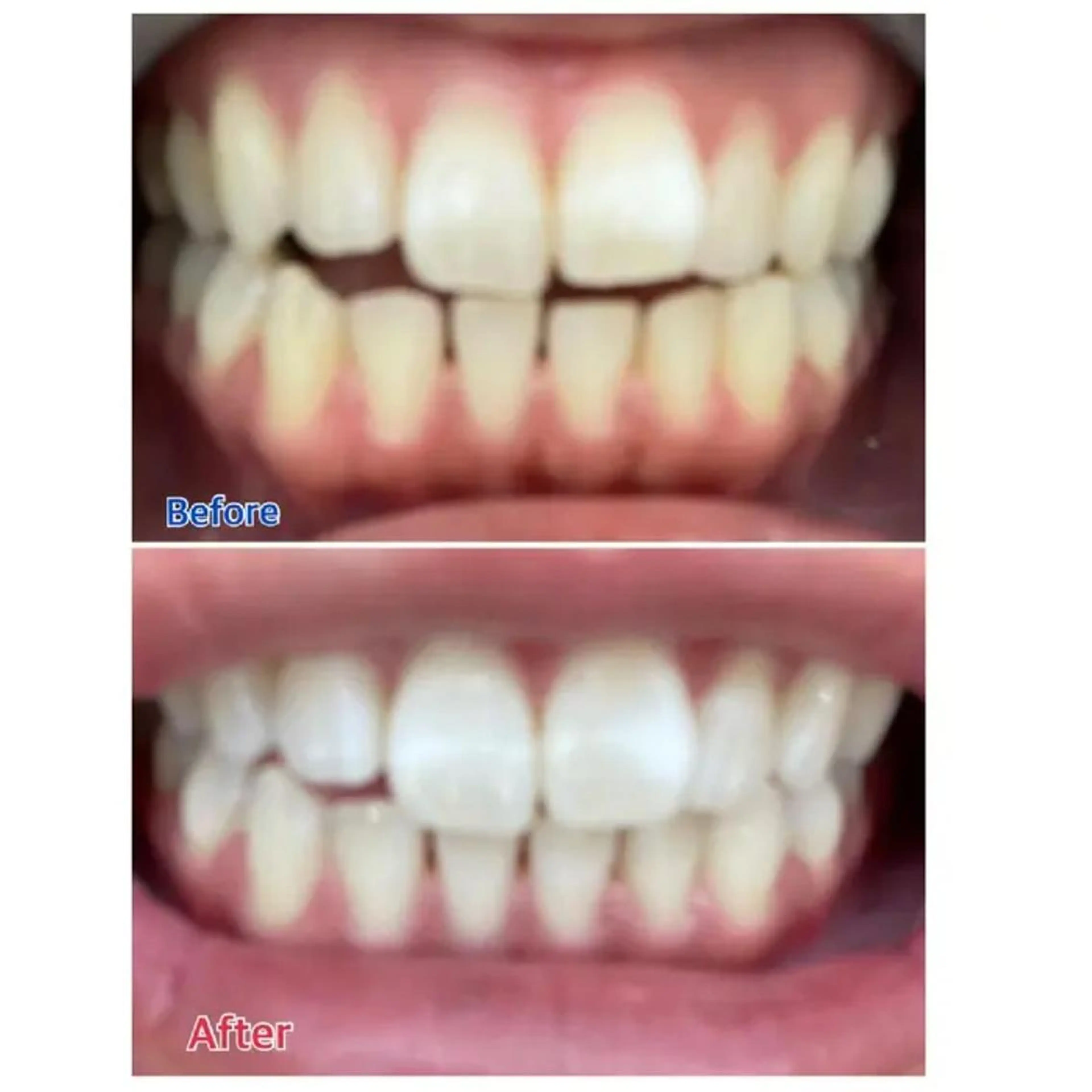 M渋谷 ホワイトニングのその他イメージ