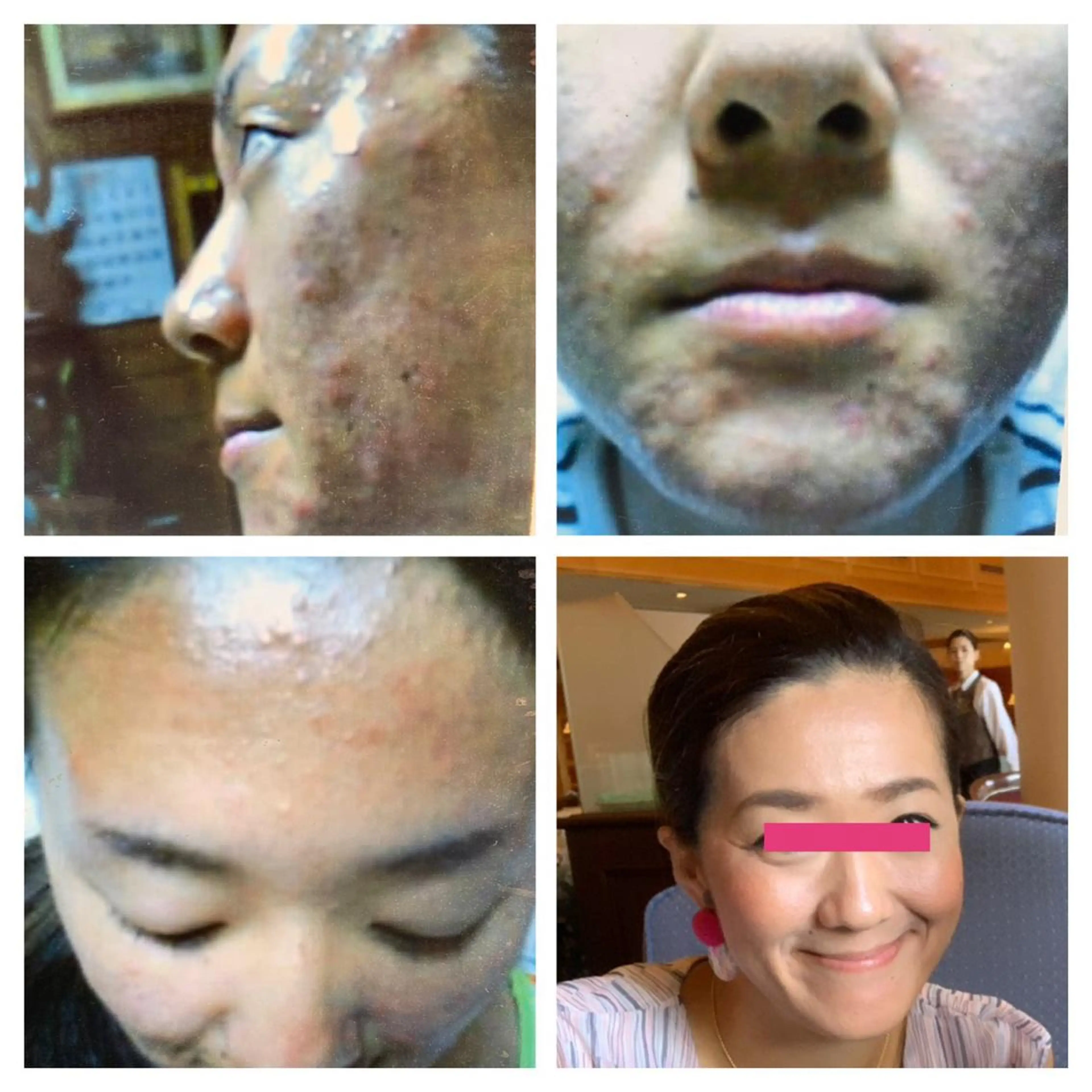 エステ 札幌ホワイトニング ラディアンス札幌駅店のその他イメージ