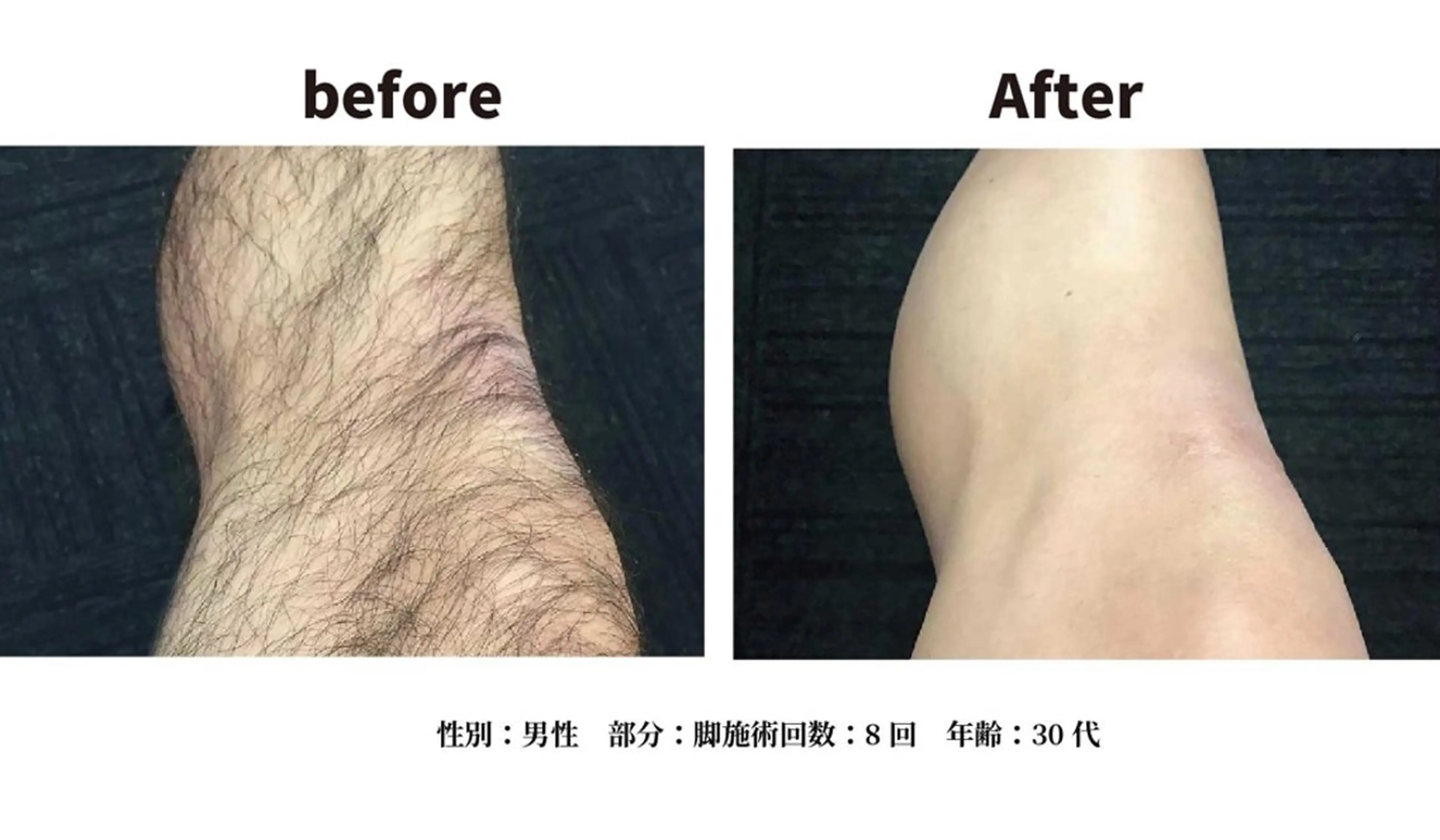 メンズ 美肌脱毛エステサロン Luangeのエステ・リラクイメージ