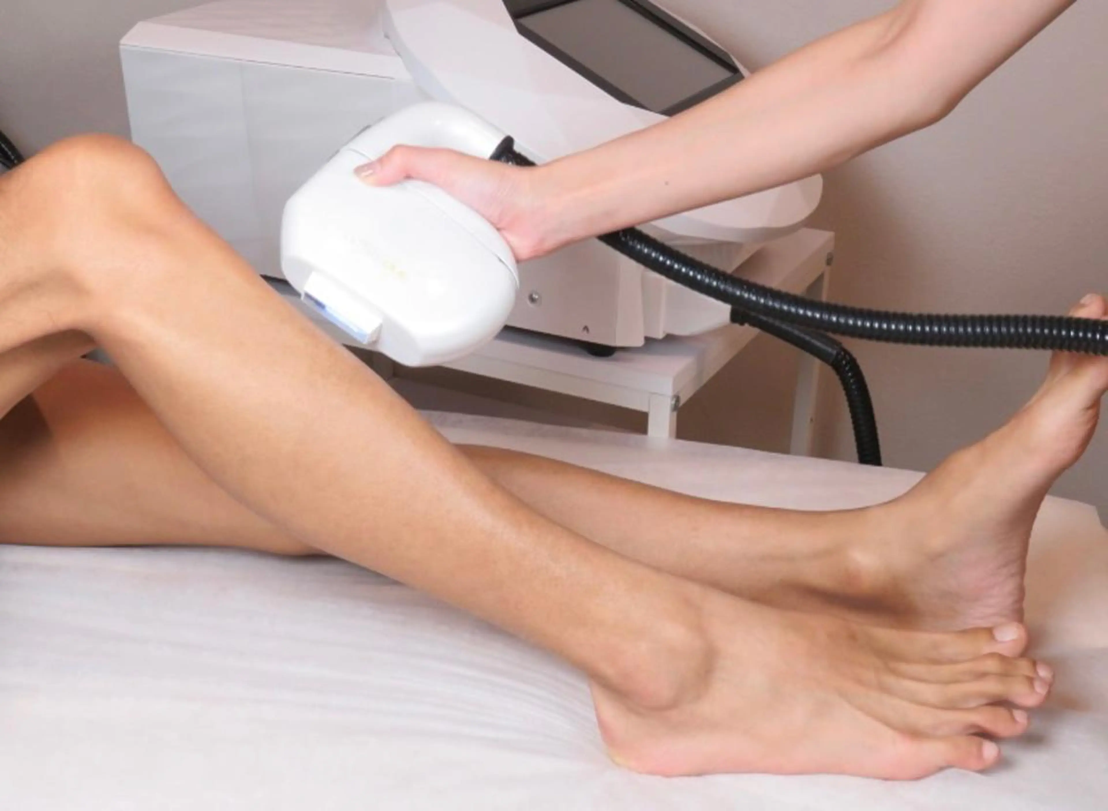 全身脱毛（顔、VIO無）（メンズ）の写真