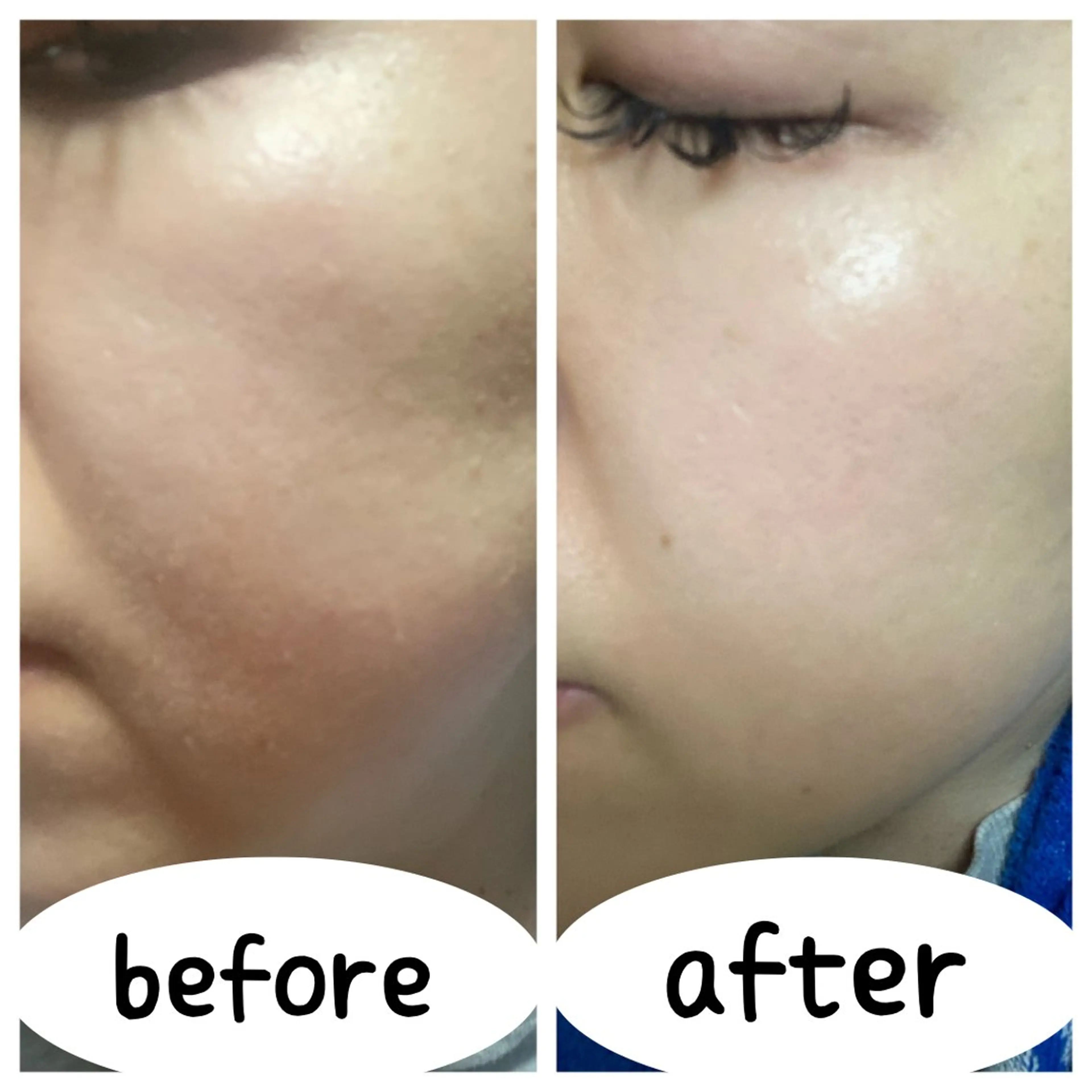 よもぎ蒸しサロン ruiangeのエステ・リラクイメージ