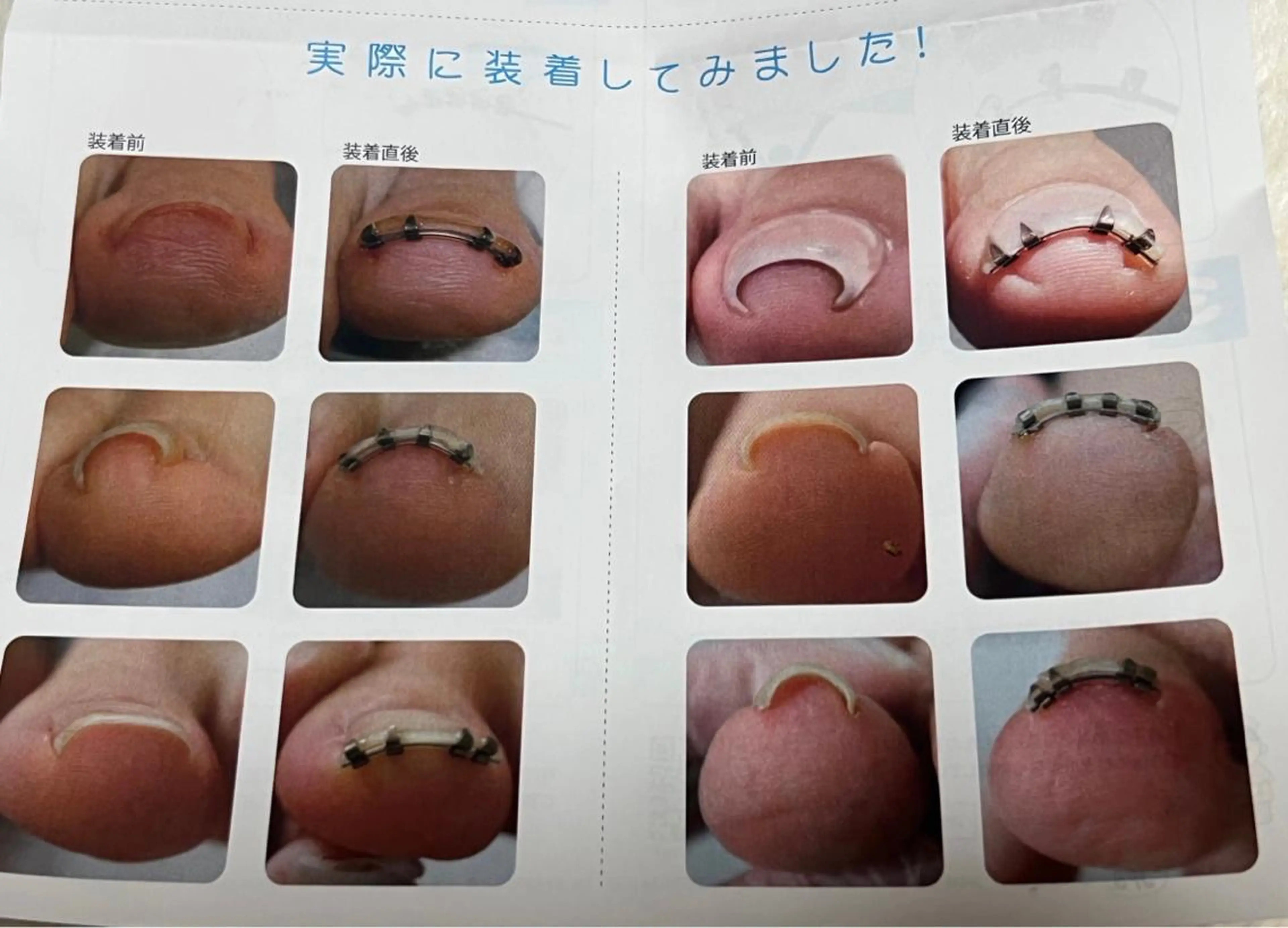 ネイル ○△□ 守口市のネイルデザイン