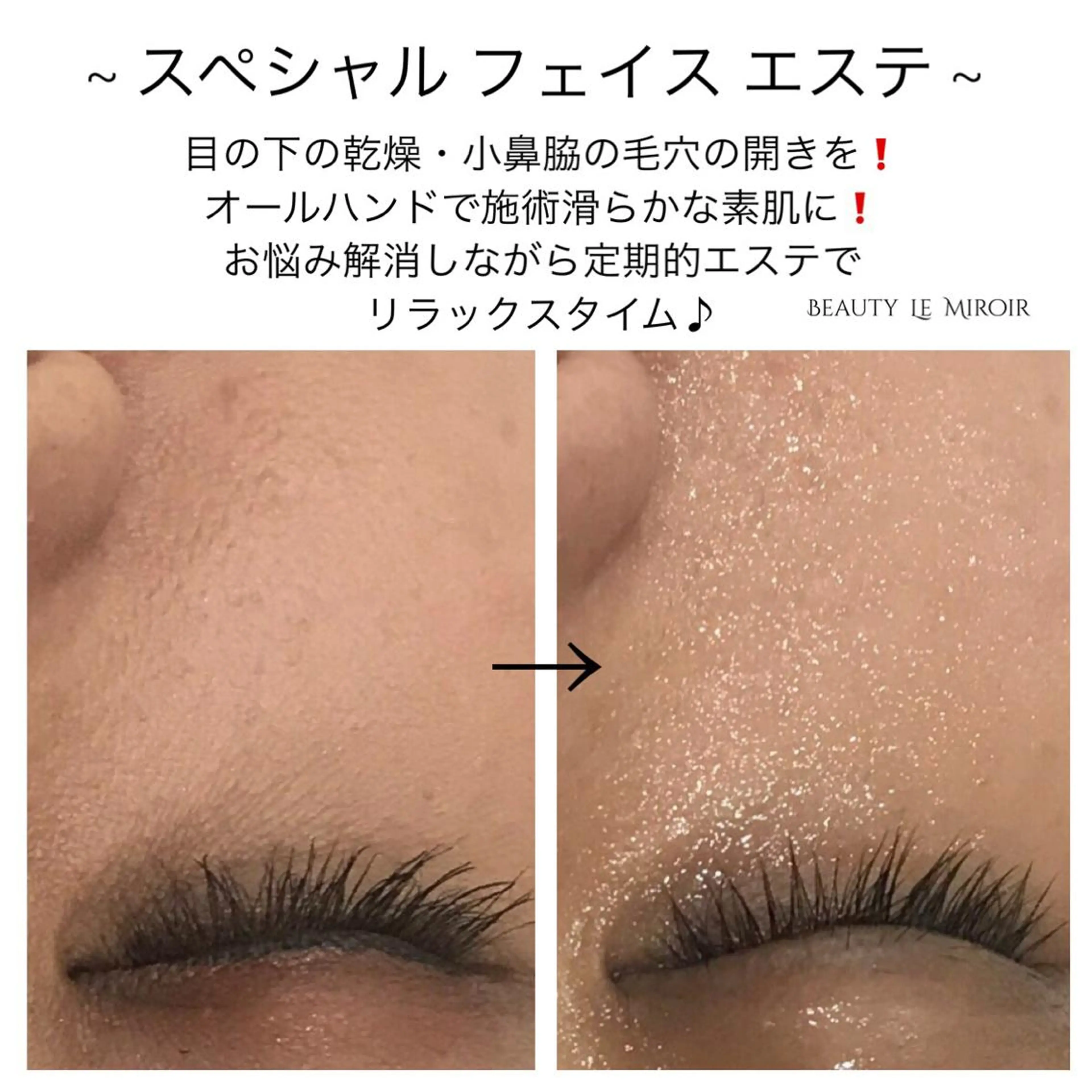 ビューティー ミロワールのエステ・リラクイメージ