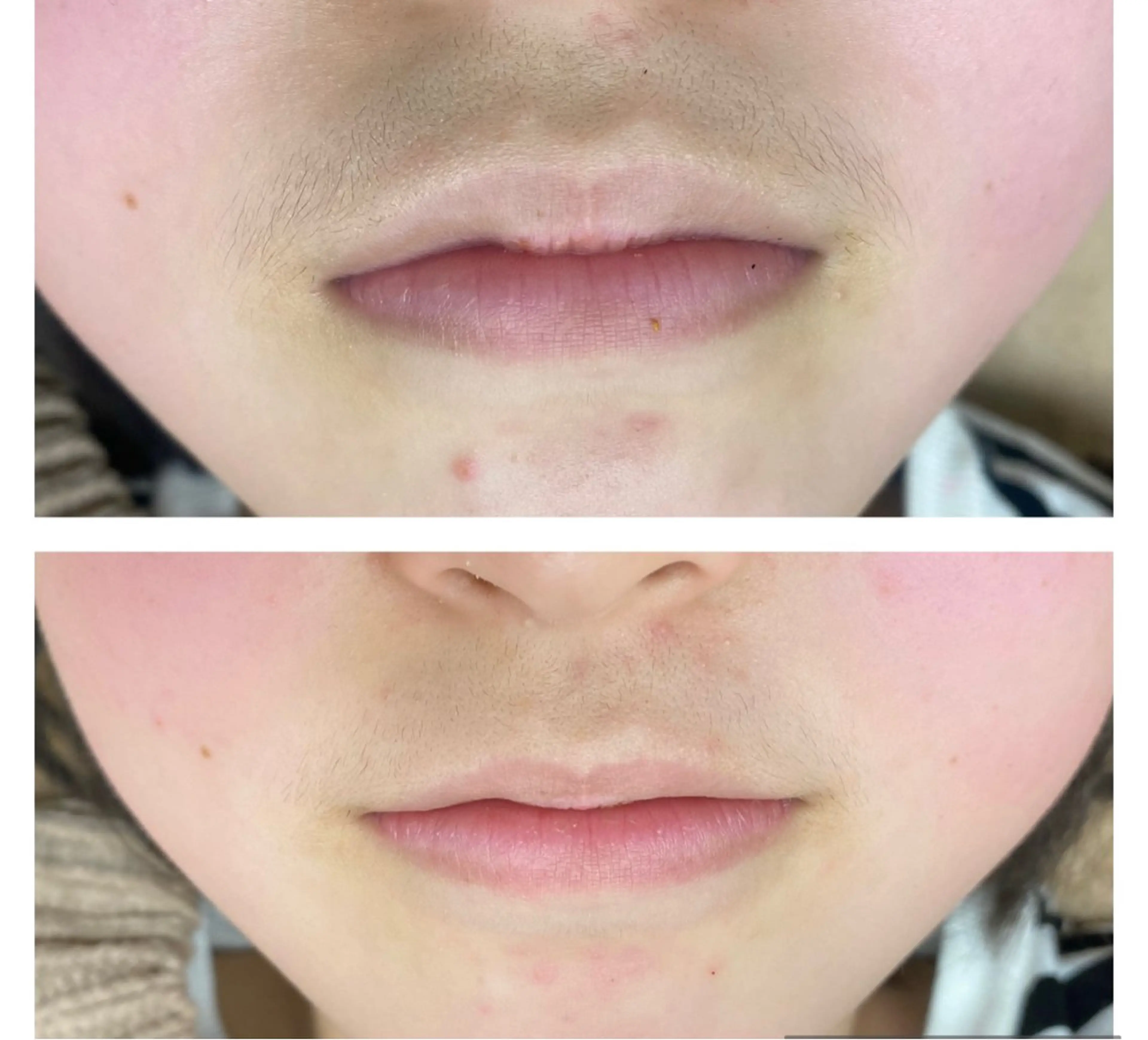 脱毛 RE:moom リムーム/脱毛エステのエステ・リラクイメージ