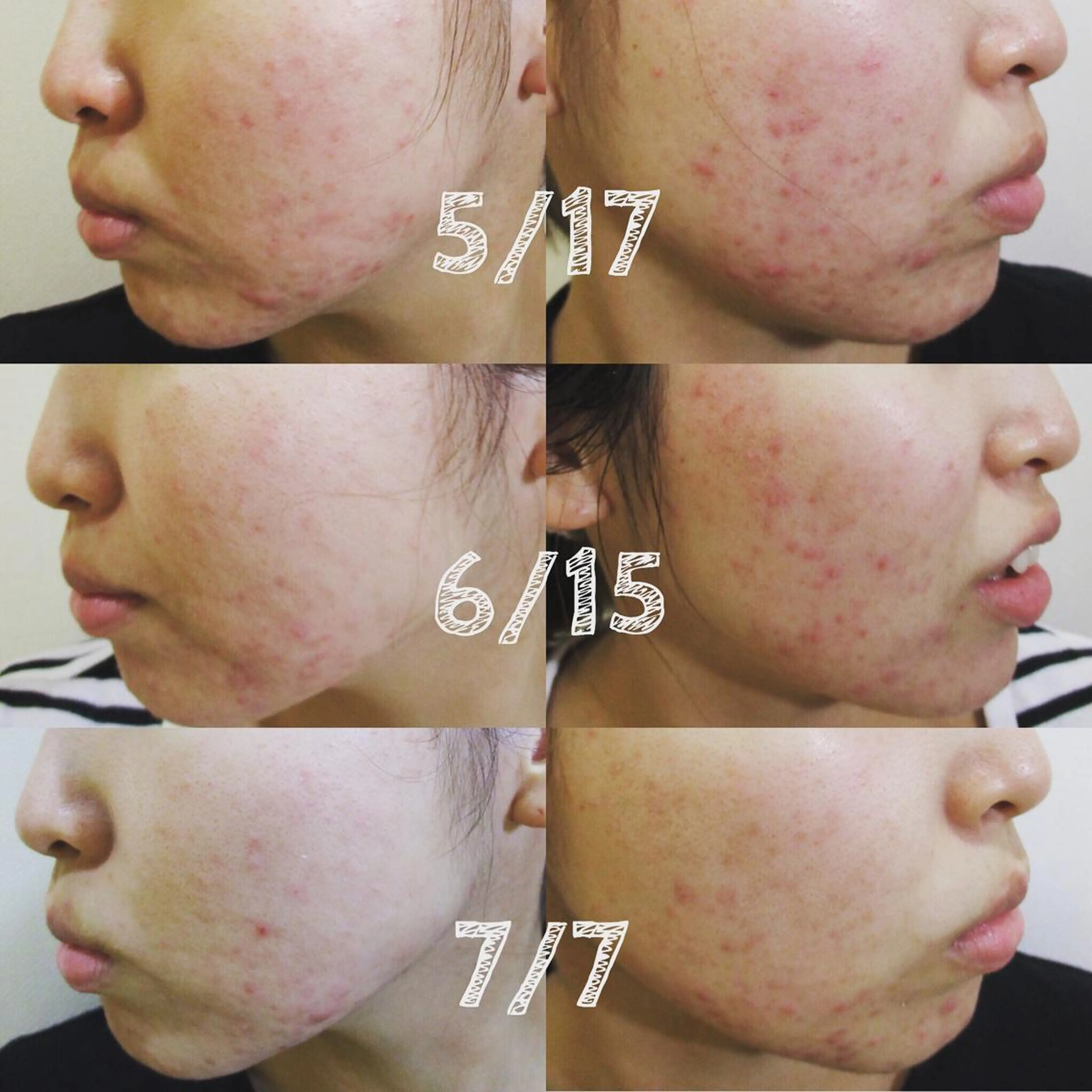 エステ 菊地 恵美のエステ・リラクイメージ