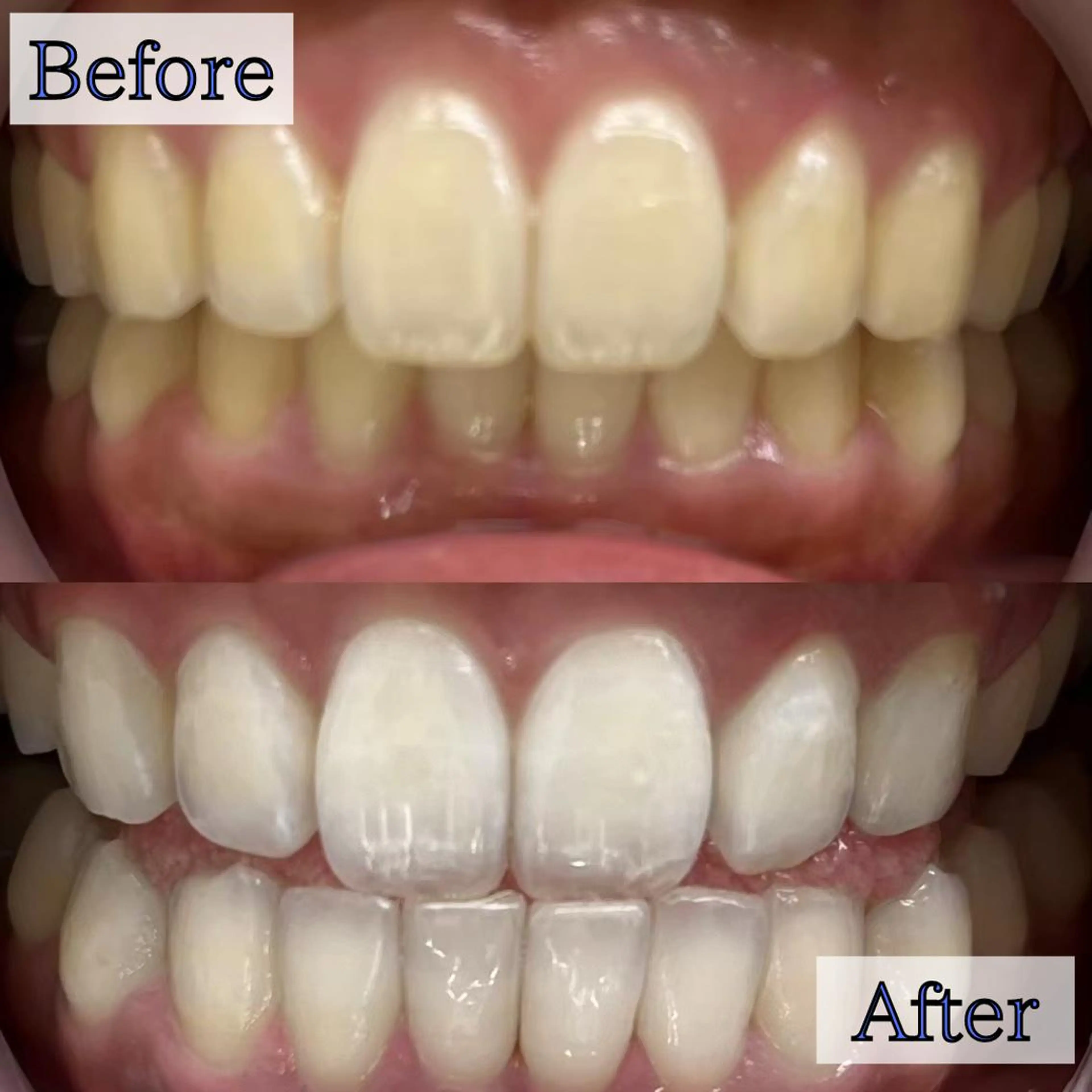 LBSホワイトニング 🌐渋谷店 小河原のエステ・リラクイメージ