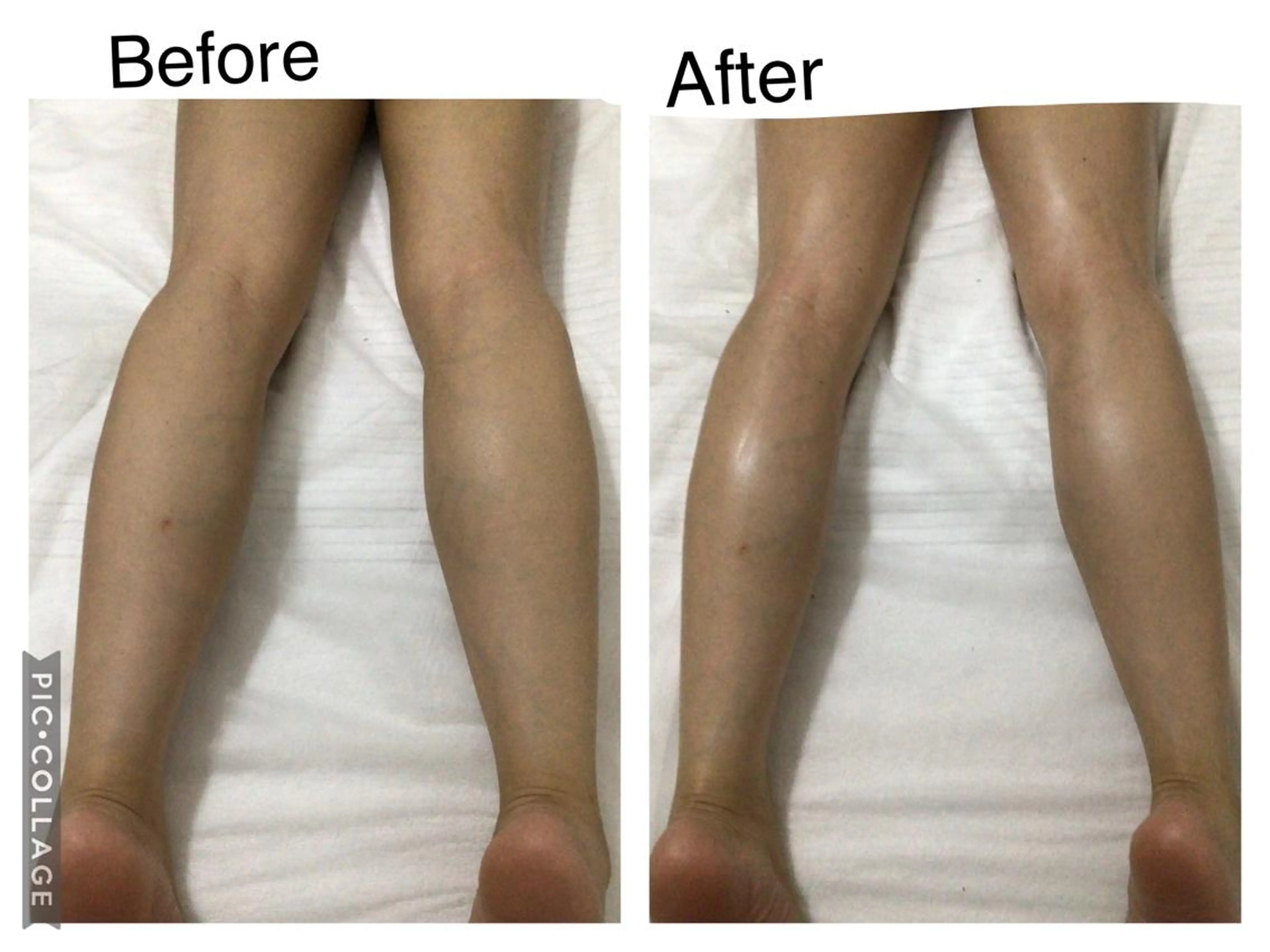 子宮矯正/腸揉み/ シュガーリング脱毛のエステ・リラクイメージ