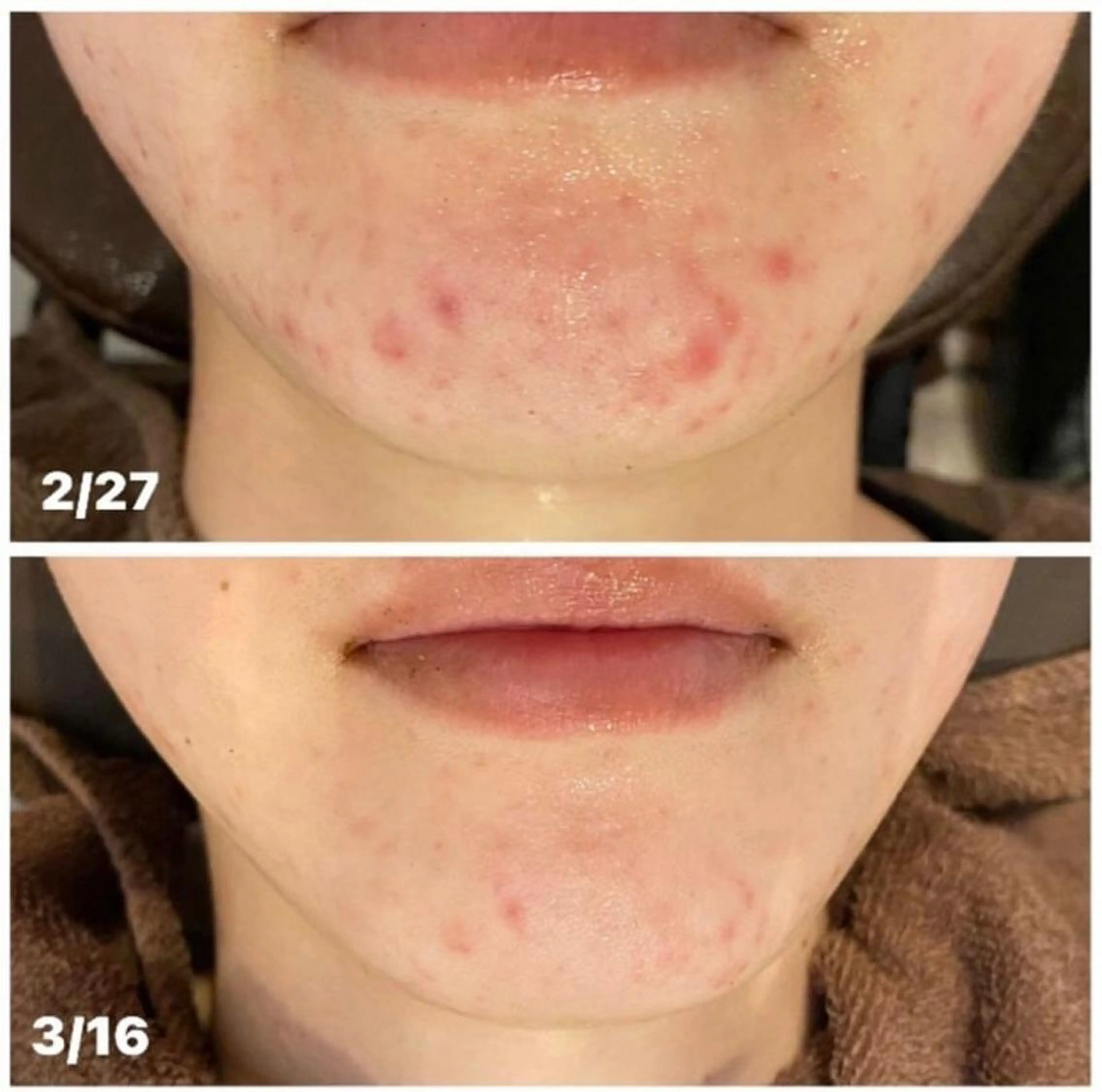 エステ リラク 本気の肌質改善スキン デトックス🌿のエステ・リラクイメージ