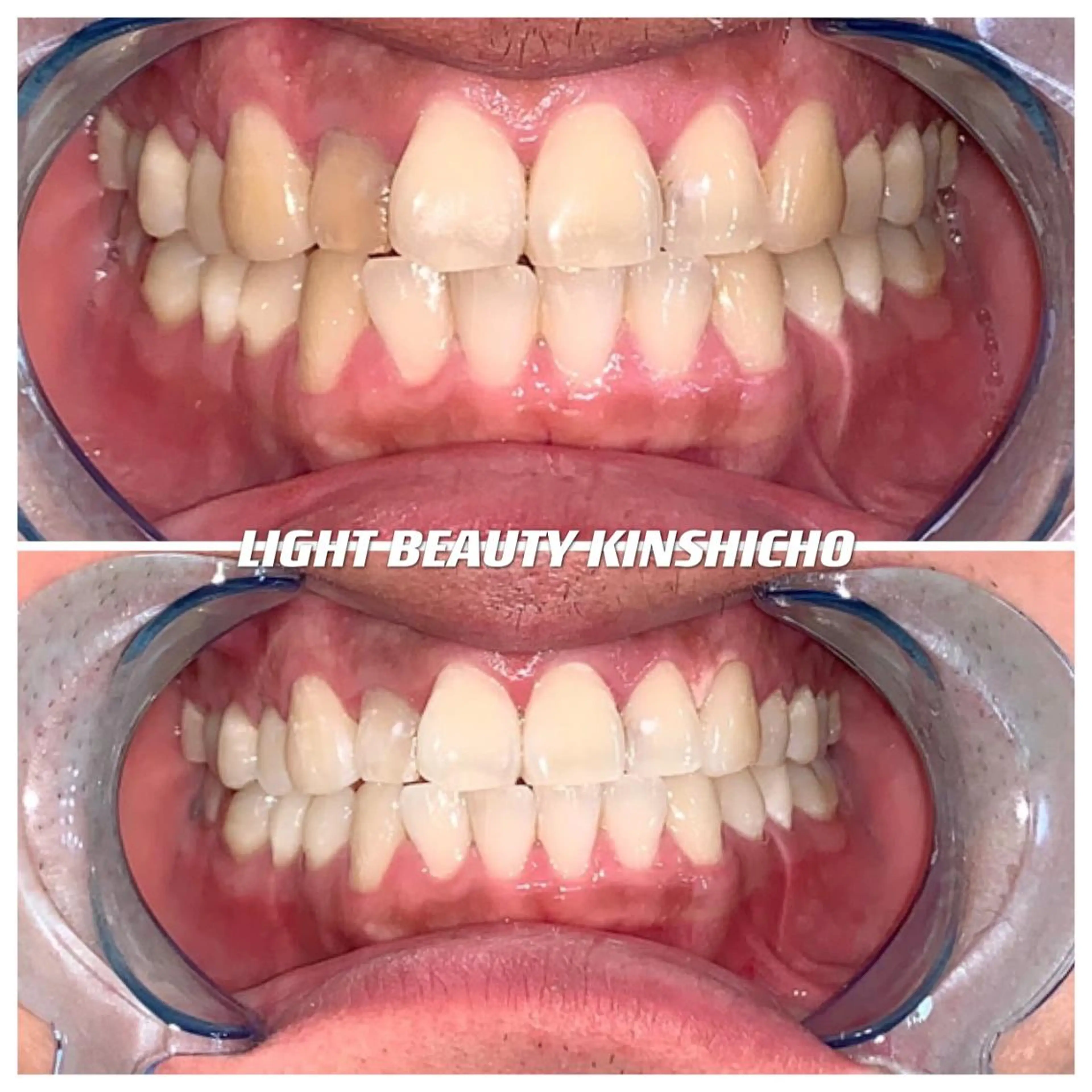 ライトビューティー 錦糸町店のエステ・リラクイメージ