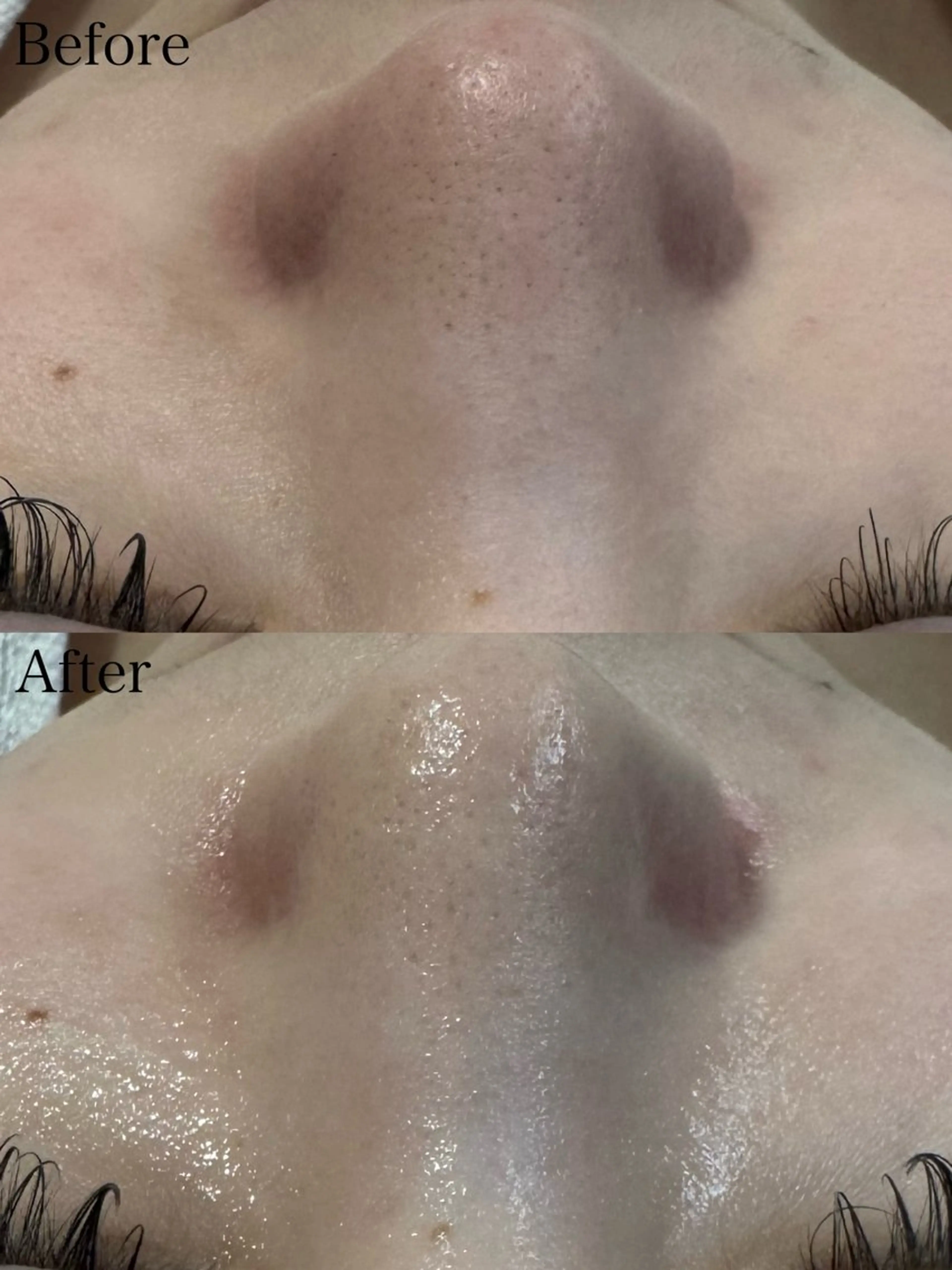 エステ beautysalon LIMOA所属・松本 愛絵理のエステ・リラクイメージ