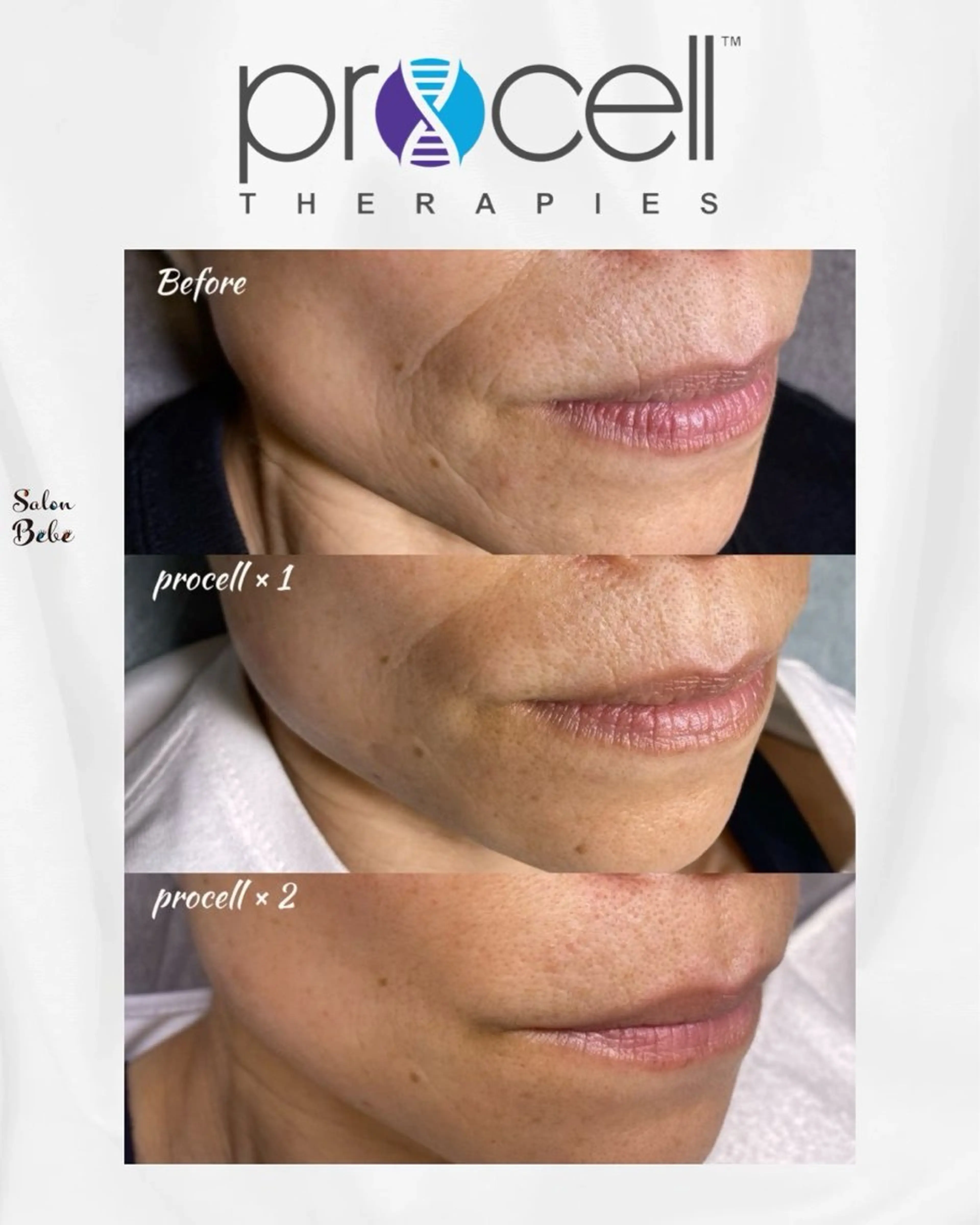 エステ Salon Bebe 名古屋のエステ・リラクイメージ