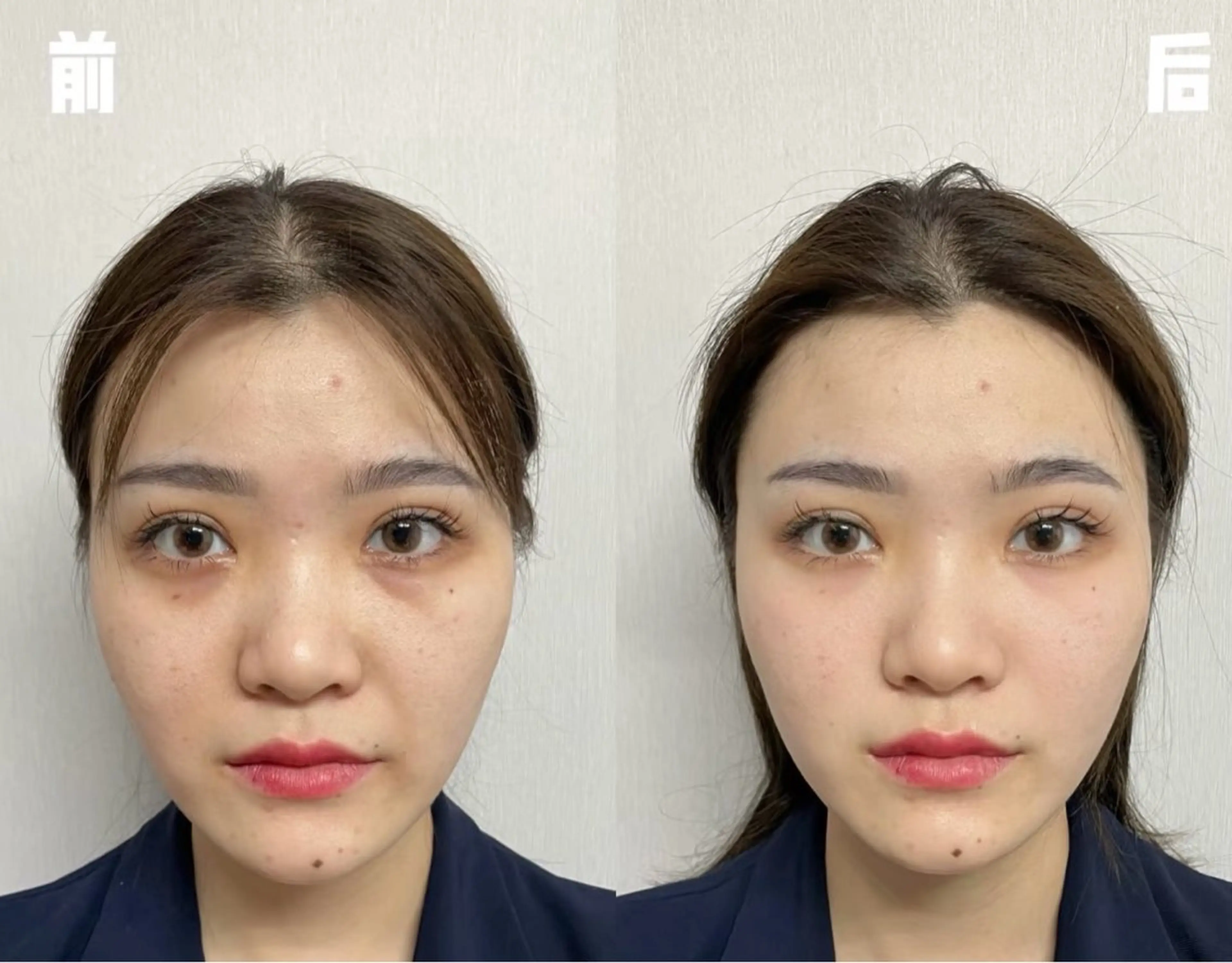 マツエク・マツパ エステ リラク 愛維美水光美肌専門店 メンズレディースokのエステ・リラクイメージ
