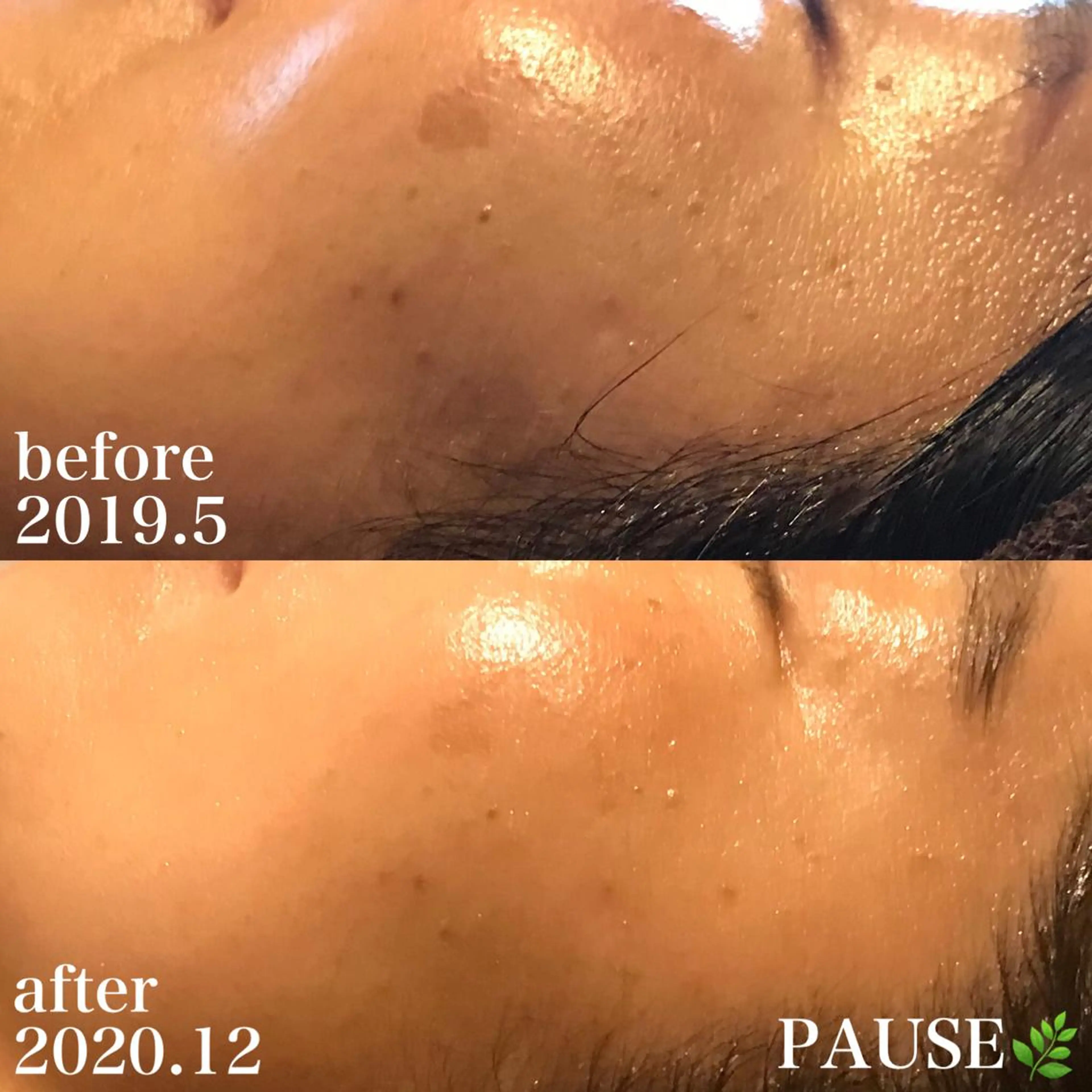 エステ 浜野 恵美のエステ・リラクイメージ