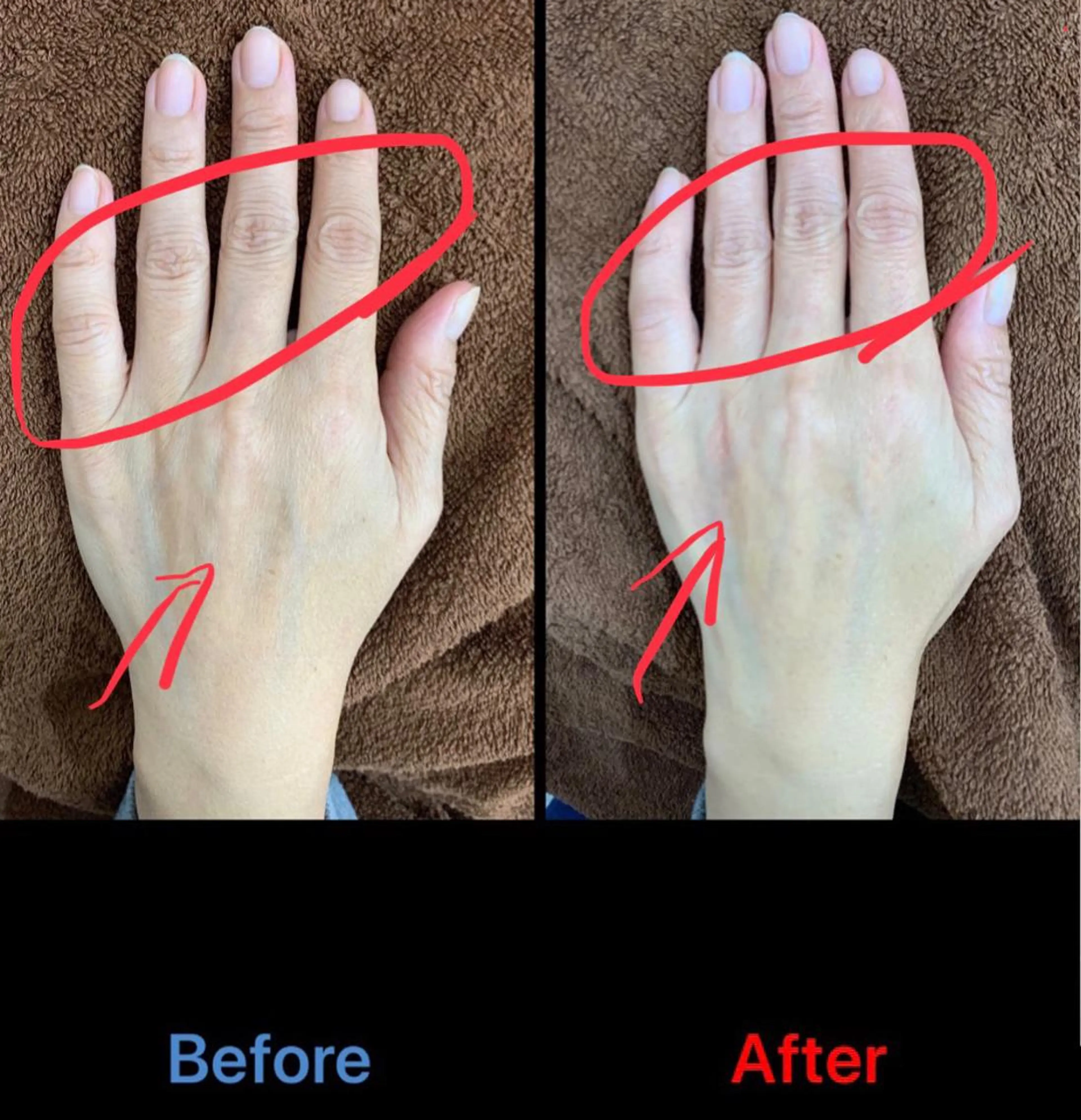 ネイル 脱毛 毛穴改善/脱毛 ネイル 川上久仁子のエステ・リラクイメージ