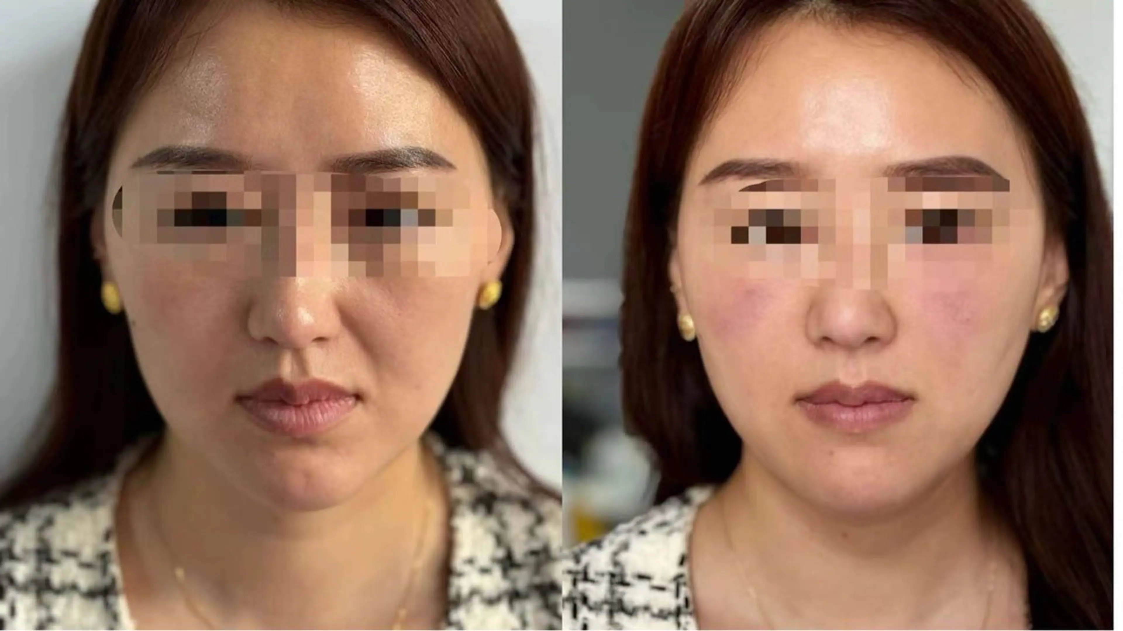 マツエク・マツパ エステ aliaハーブ水光店 エステティシャン募集のエステ・リラクイメージ