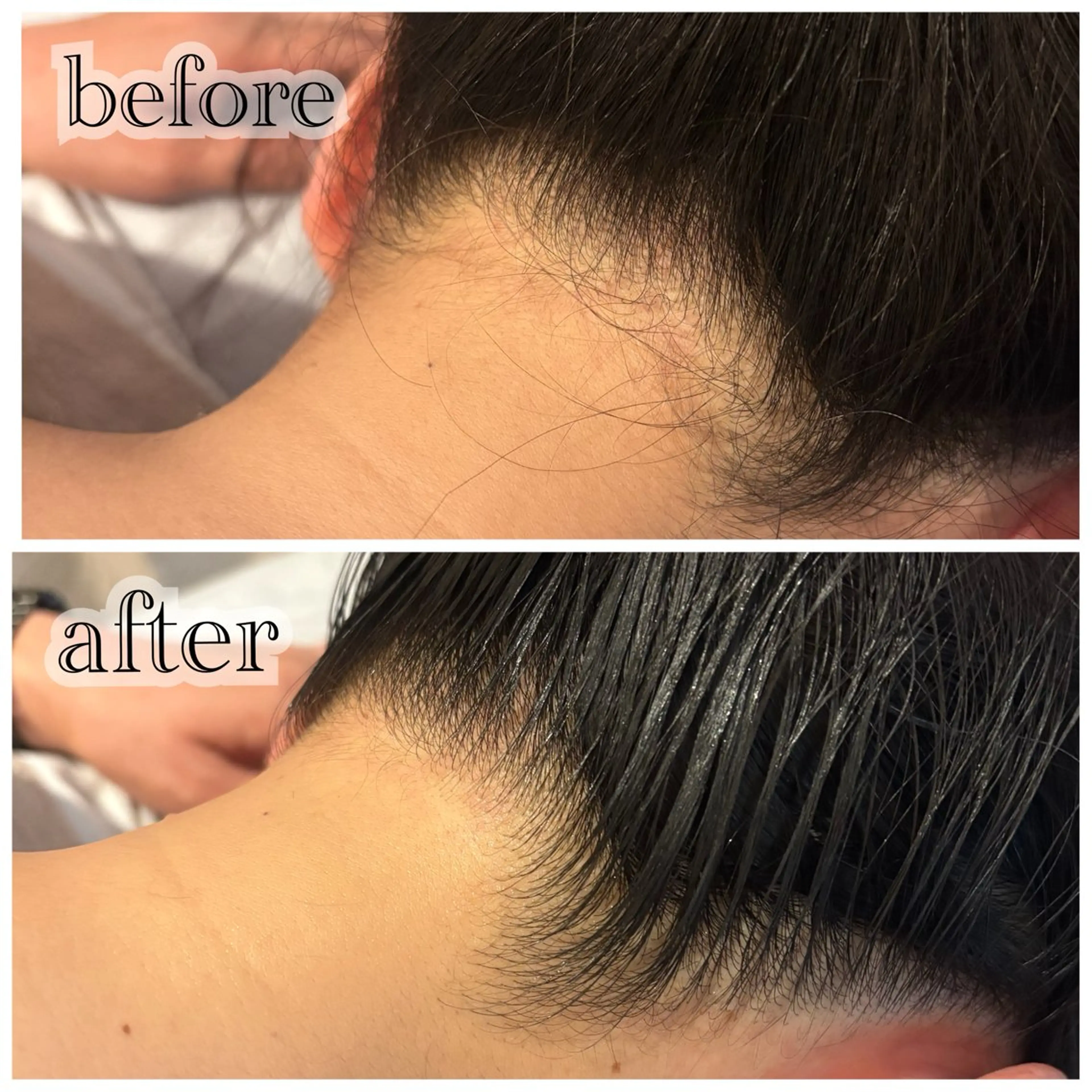 メンズ脱毛サロン SHINKAのエステ・リラクイメージ