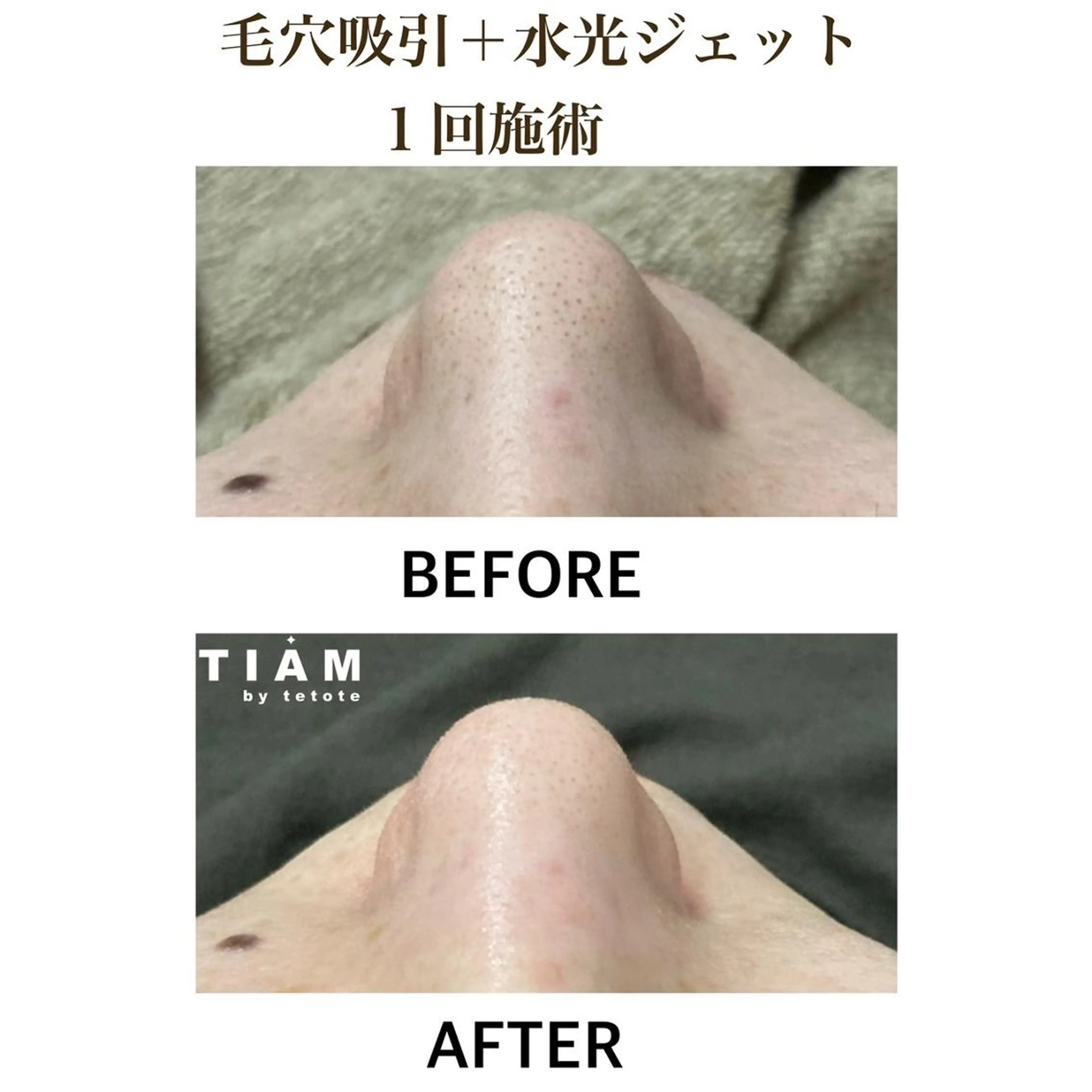 美肌サロンTIAM by tetoteのエステ・リラクイメージ