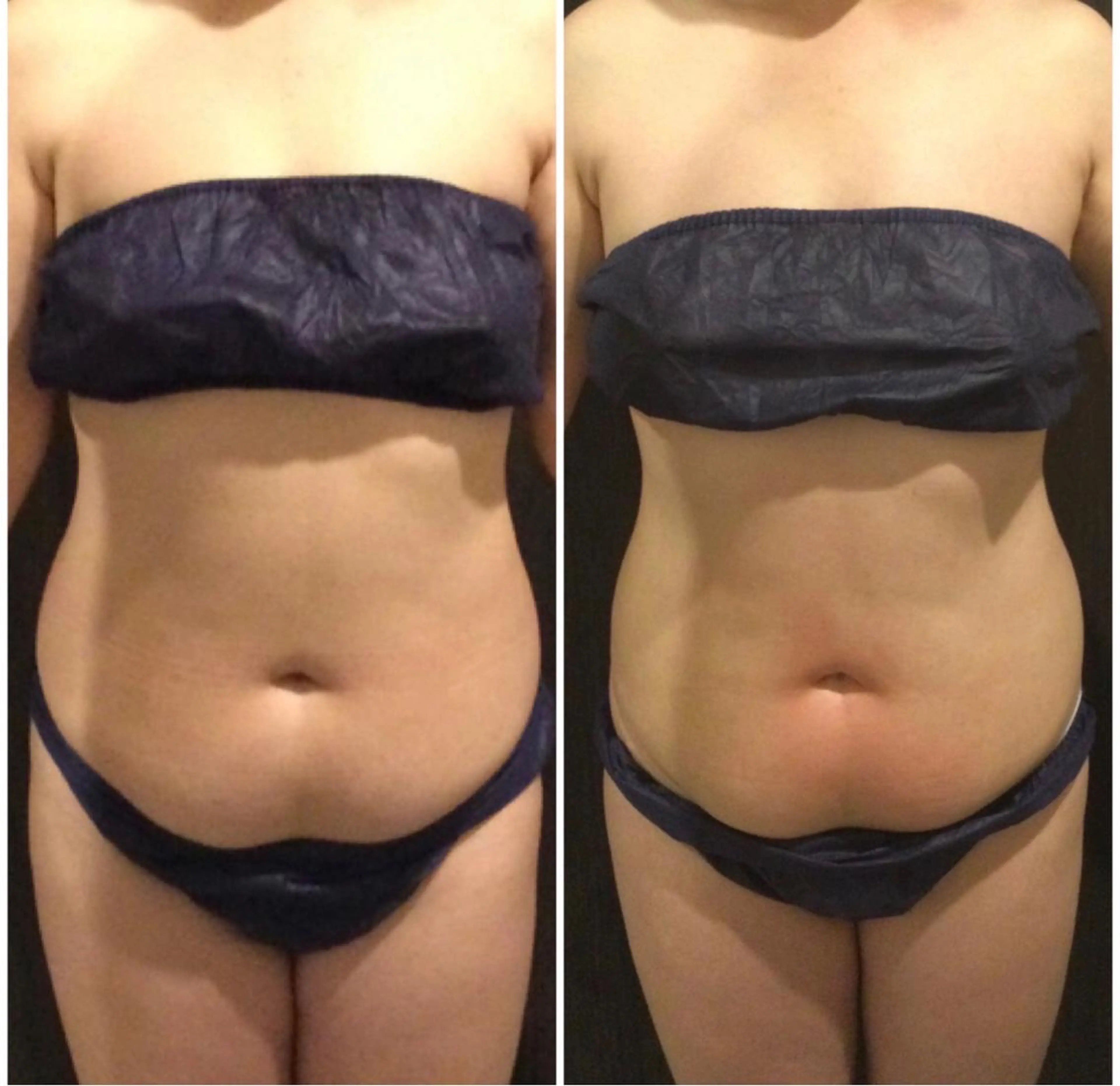 Re, Luxのエステ・リラクイメージ