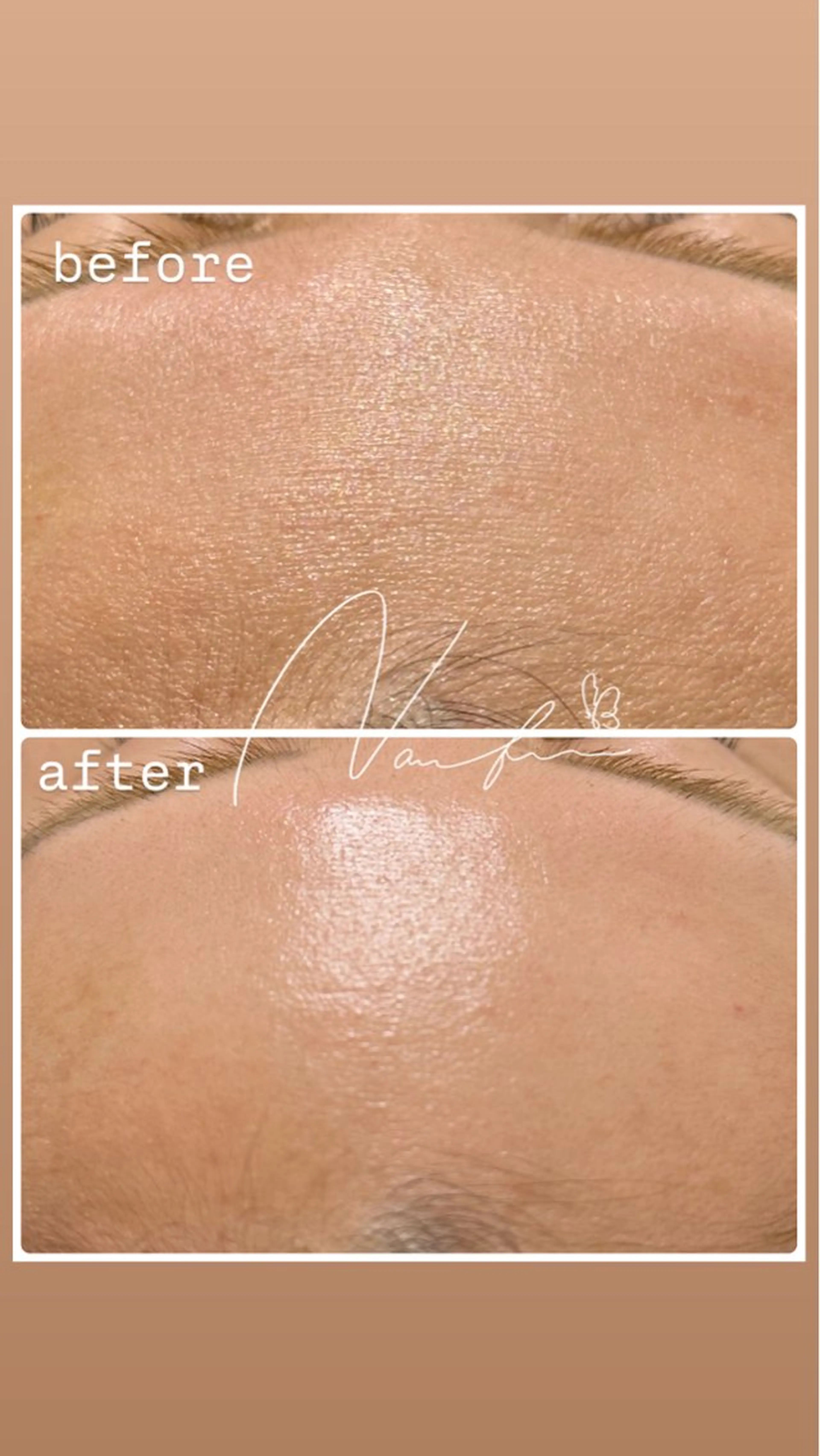 エステ nailsalon Nabiのネイルデザイン