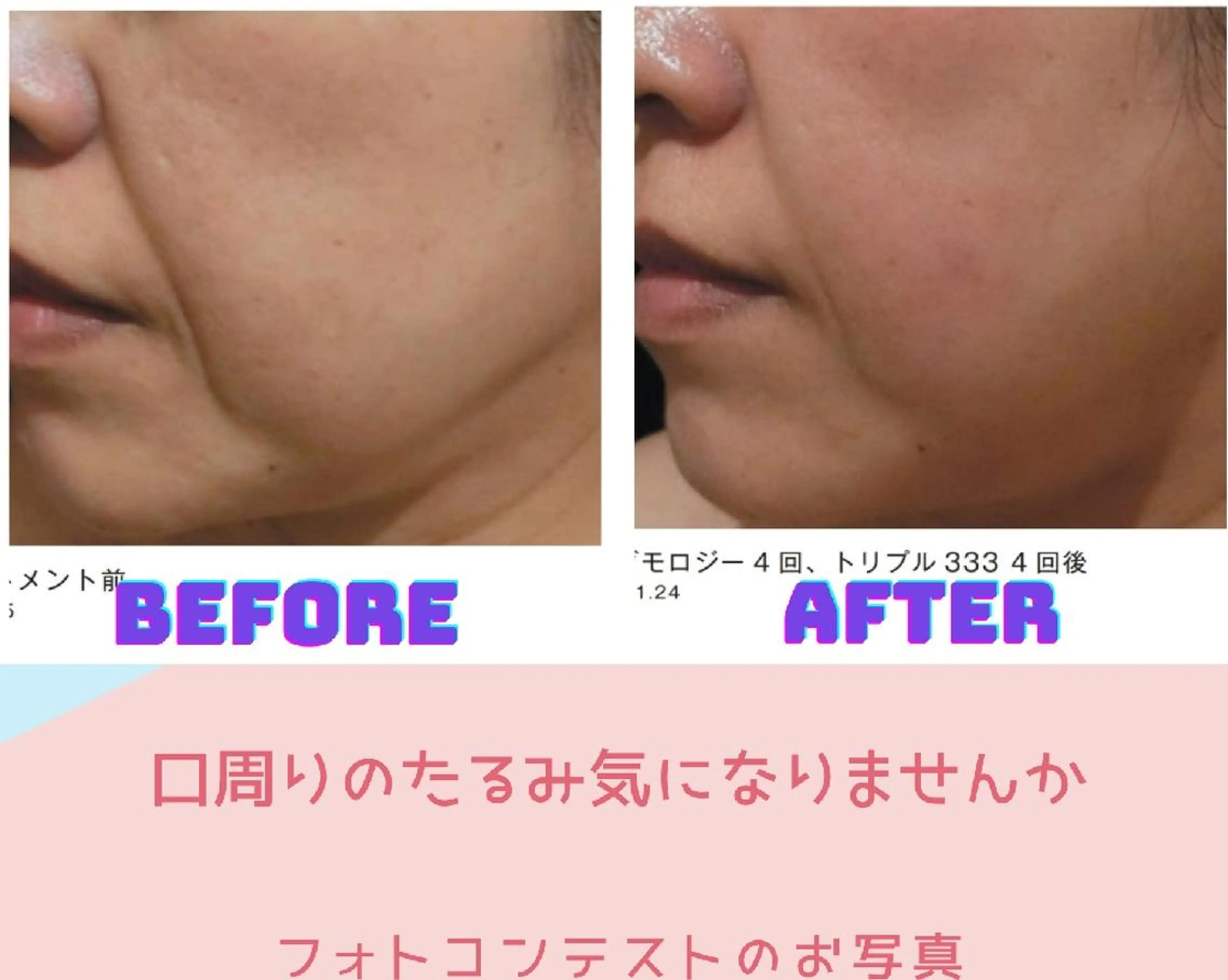 エステ Cantik Cantik チャンティチャンティ所属・高橋 志保のエステ・リラクイメージ