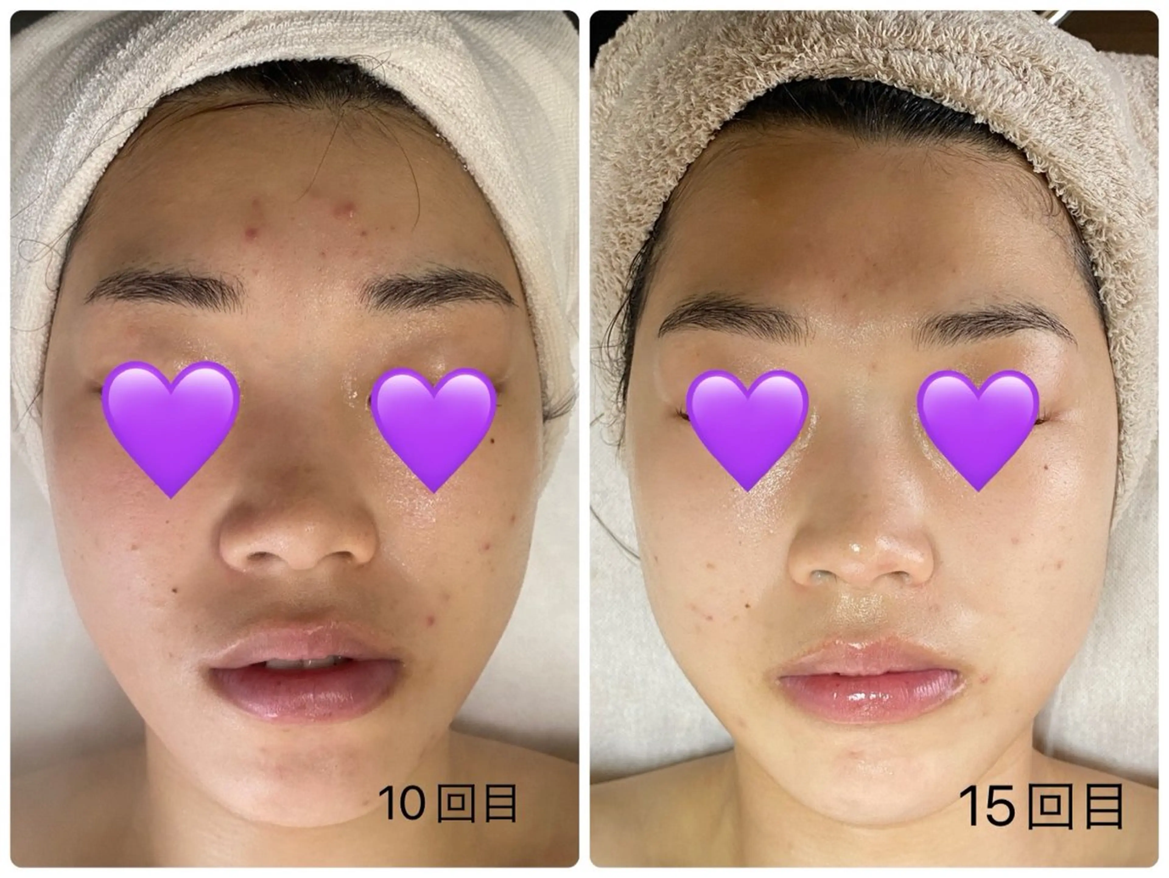 COCO beautyサロンのエステ・リラクイメージ