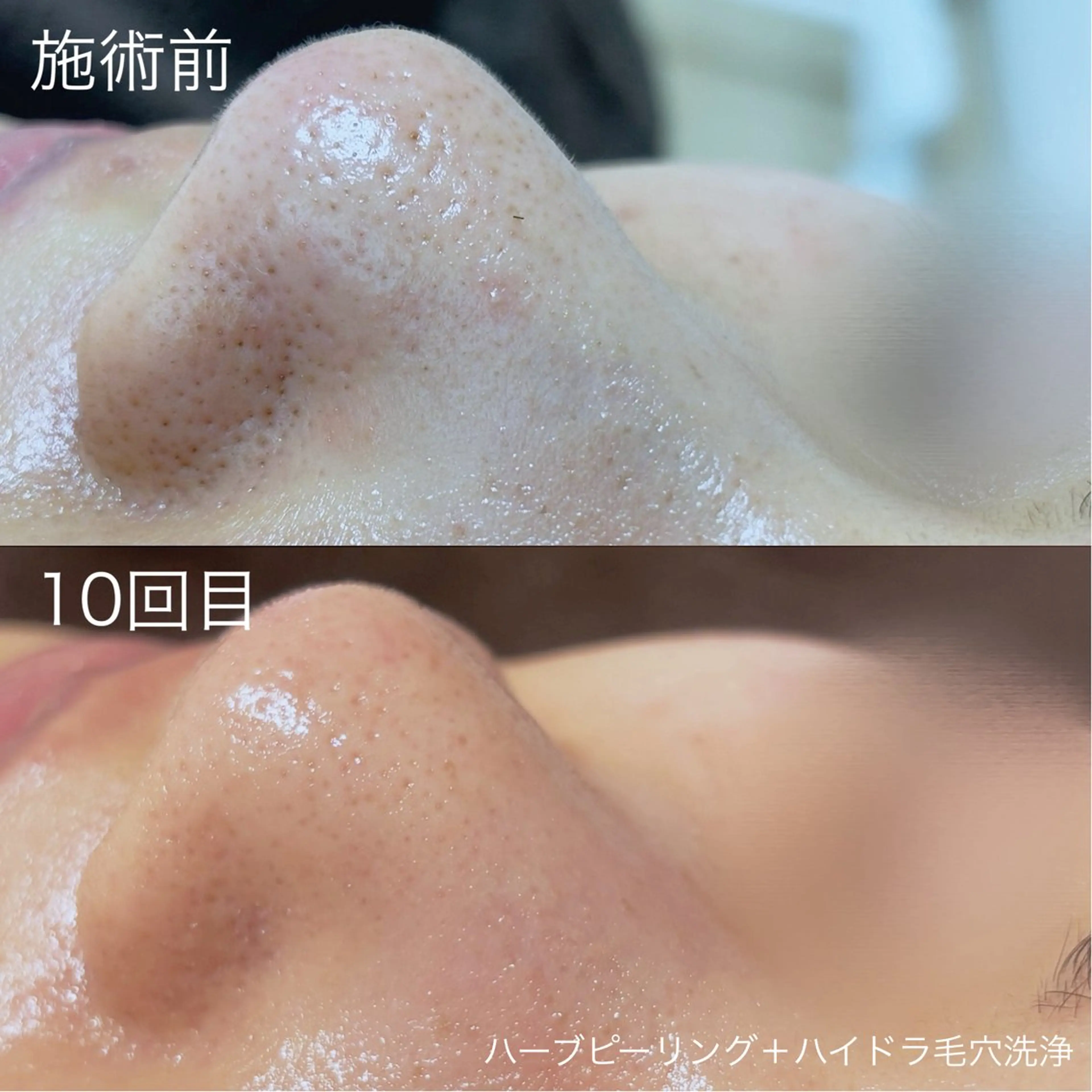 脱毛 lulula ricoのエステ・リラクイメージ