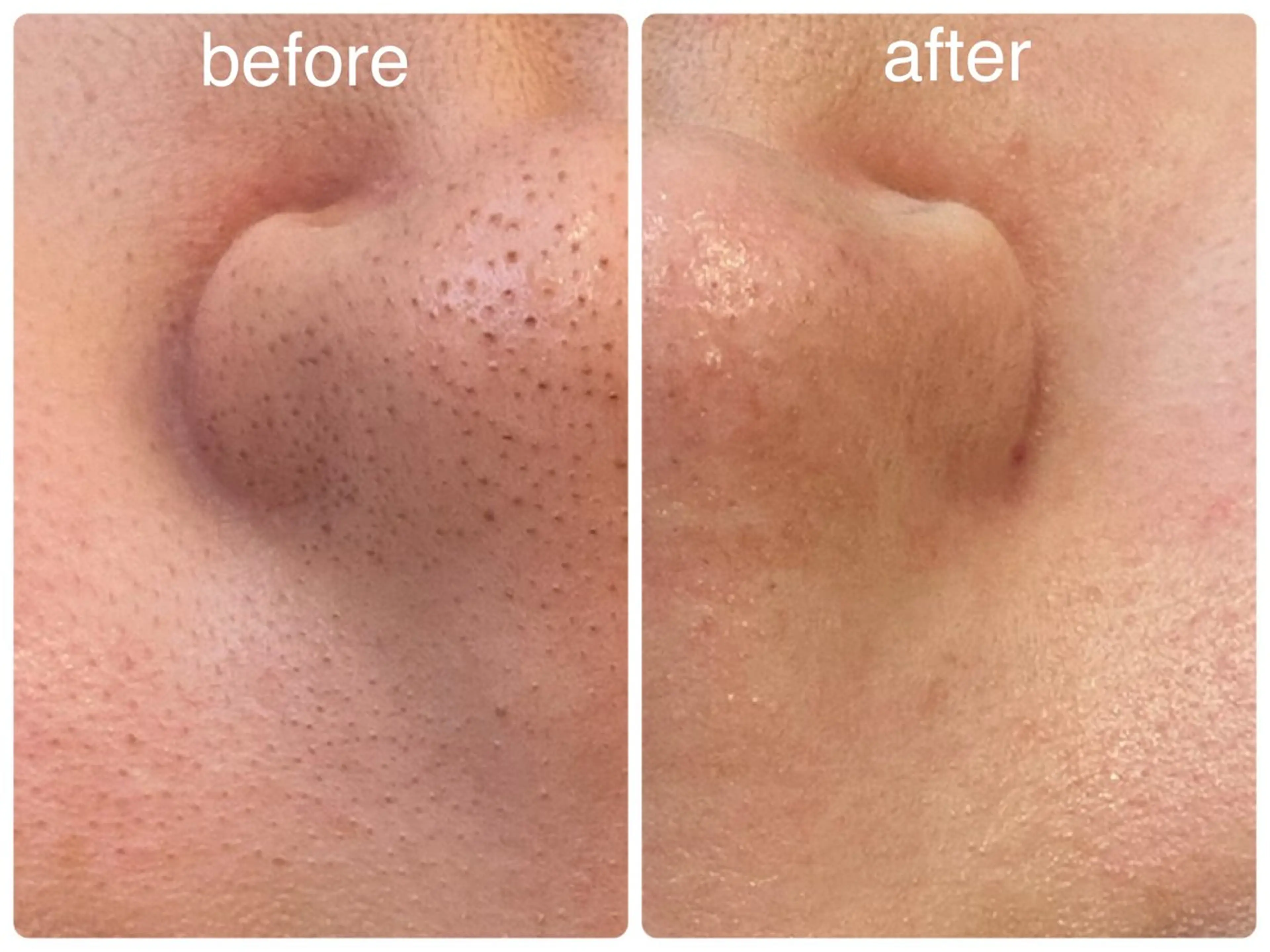 エステ Hisui 小出のエステ・リラクイメージ