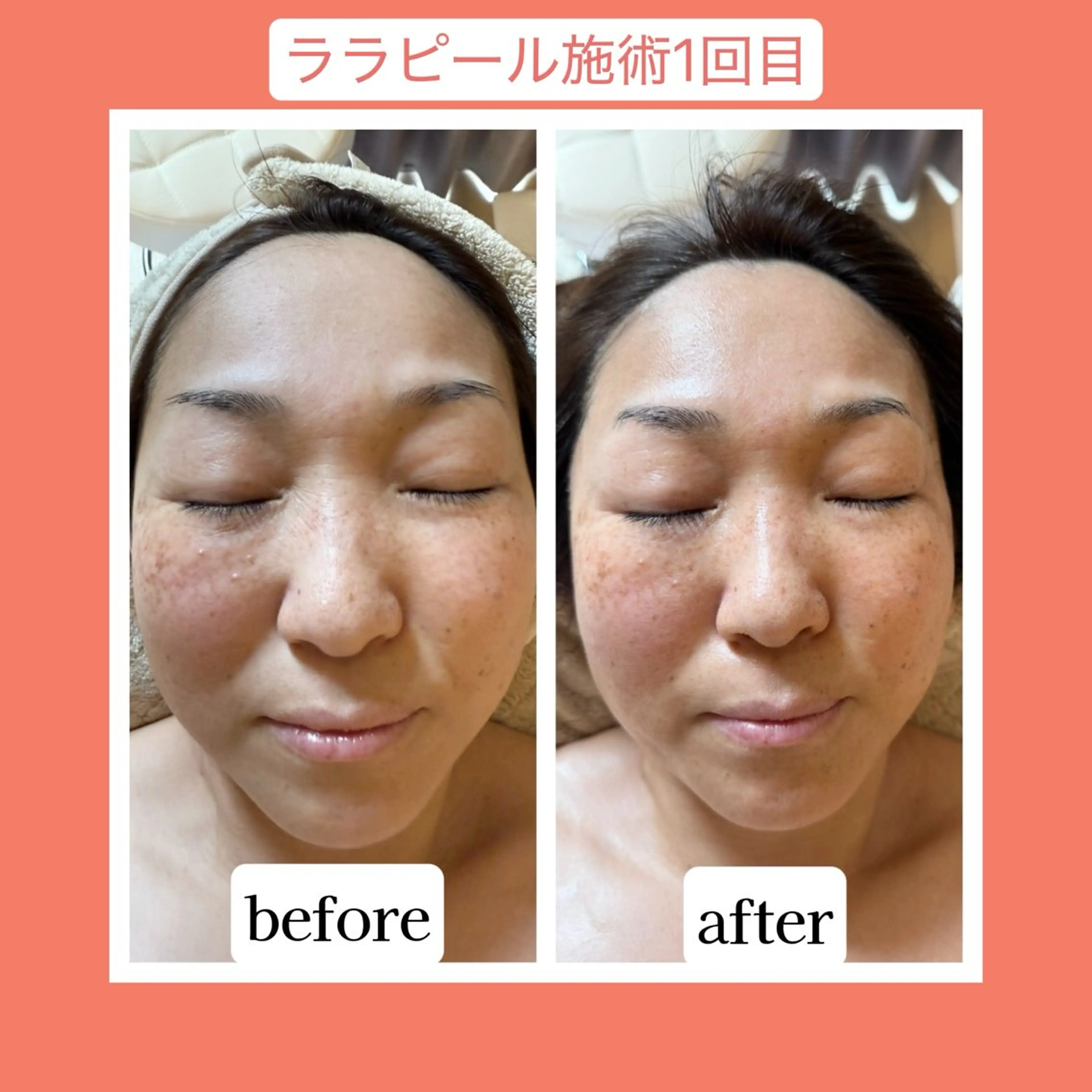 💜Karen PrivateSpaのエステ・リラクイメージ