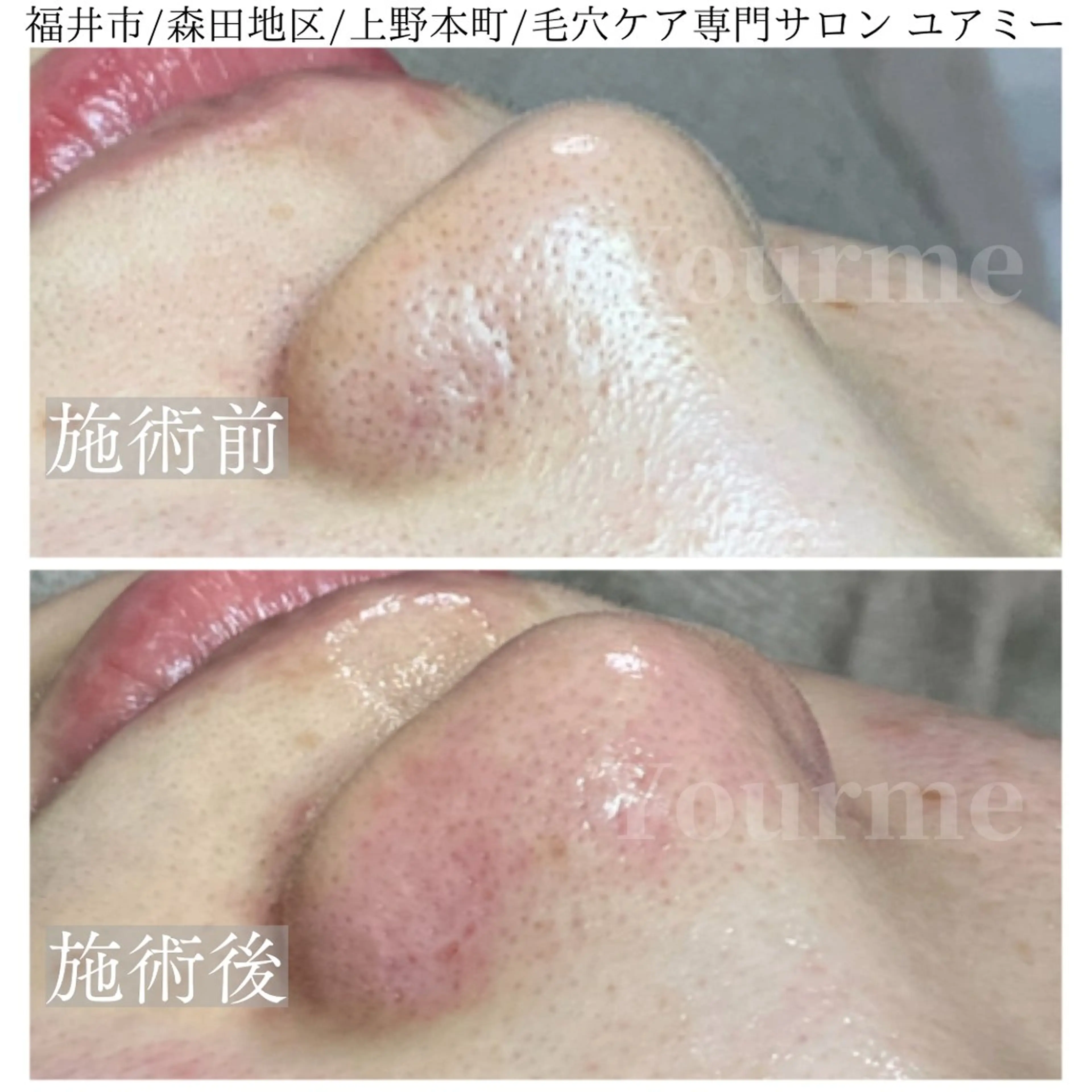 毛穴肌質ケアサロン Yourmeユアミーのエステ・リラクイメージ