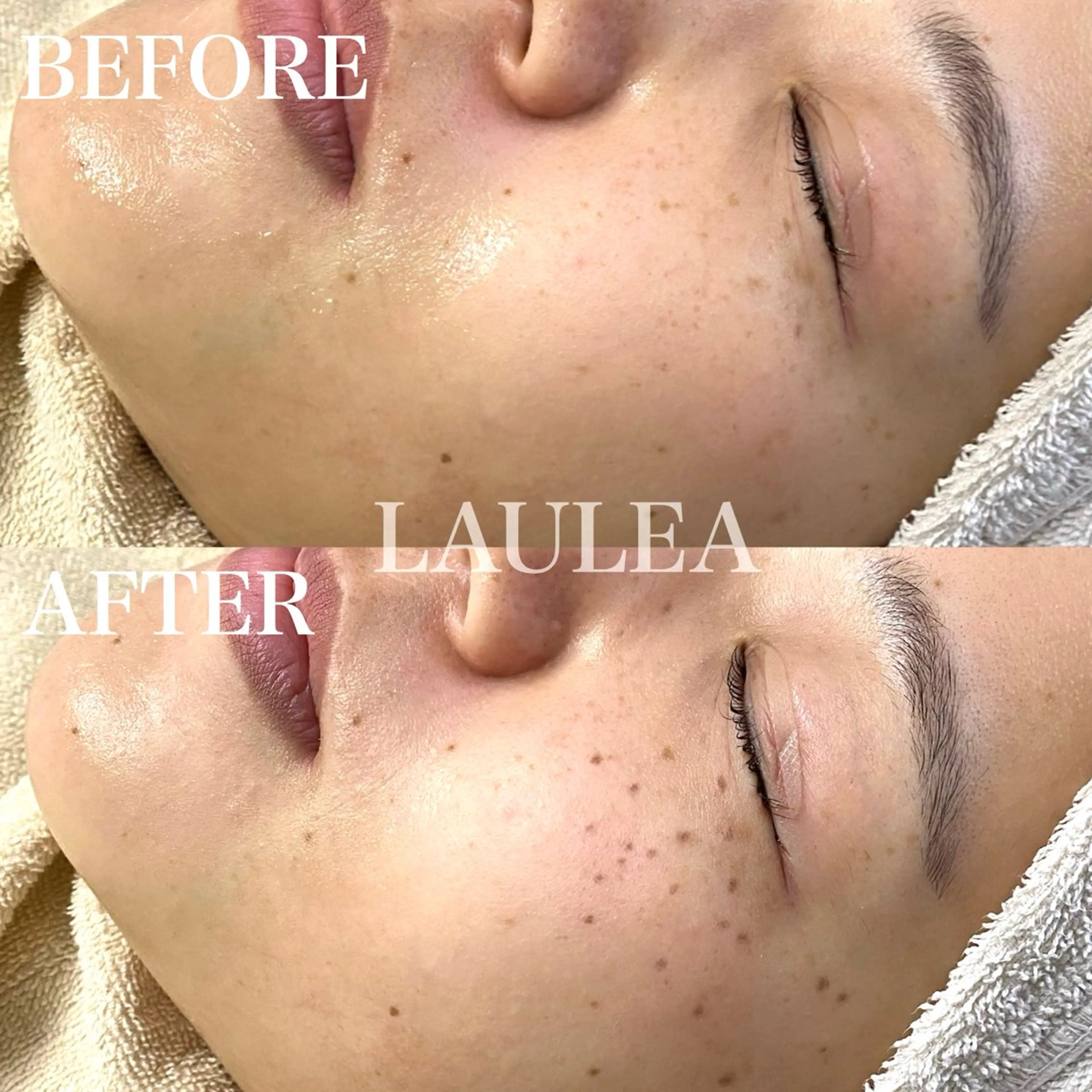 エステ 素肌をキレイに ラウレア🌼Hayaのエステ・リラクイメージ