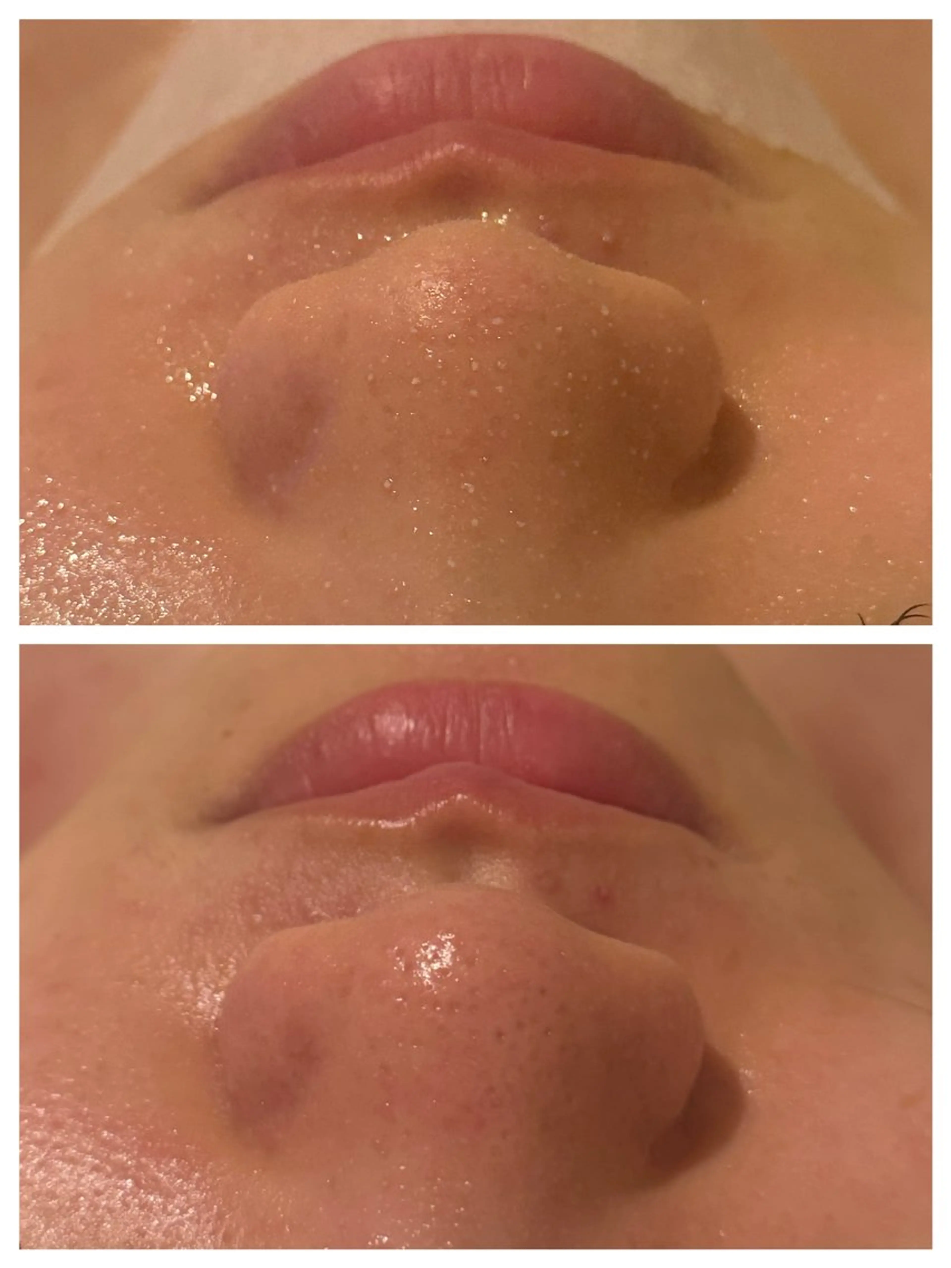 痩身・小顔・脱毛・ オイル&Amourのその他イメージ