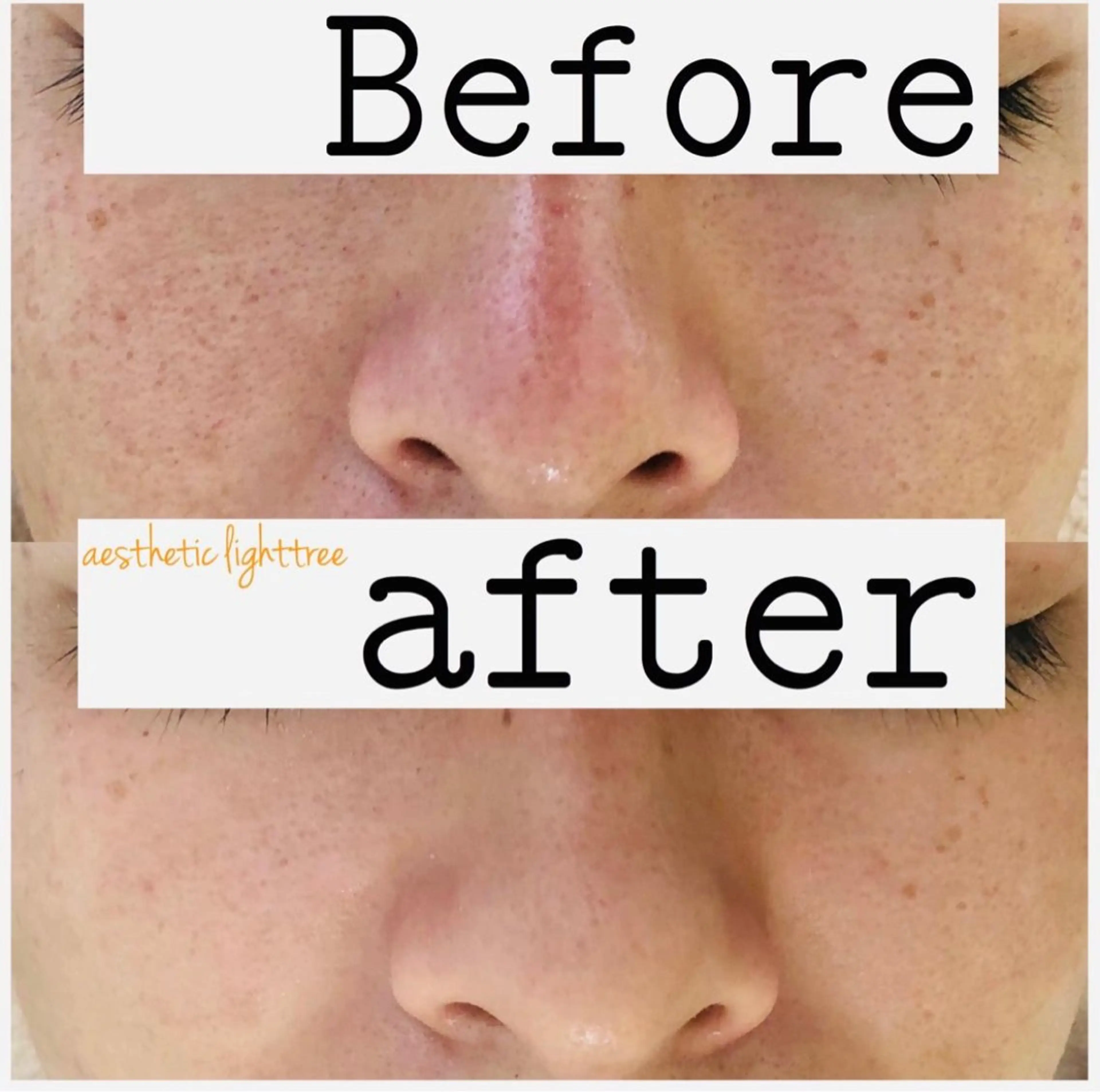 都度払い肌改善専門店 店長二上文香のエステ・リラクイメージ