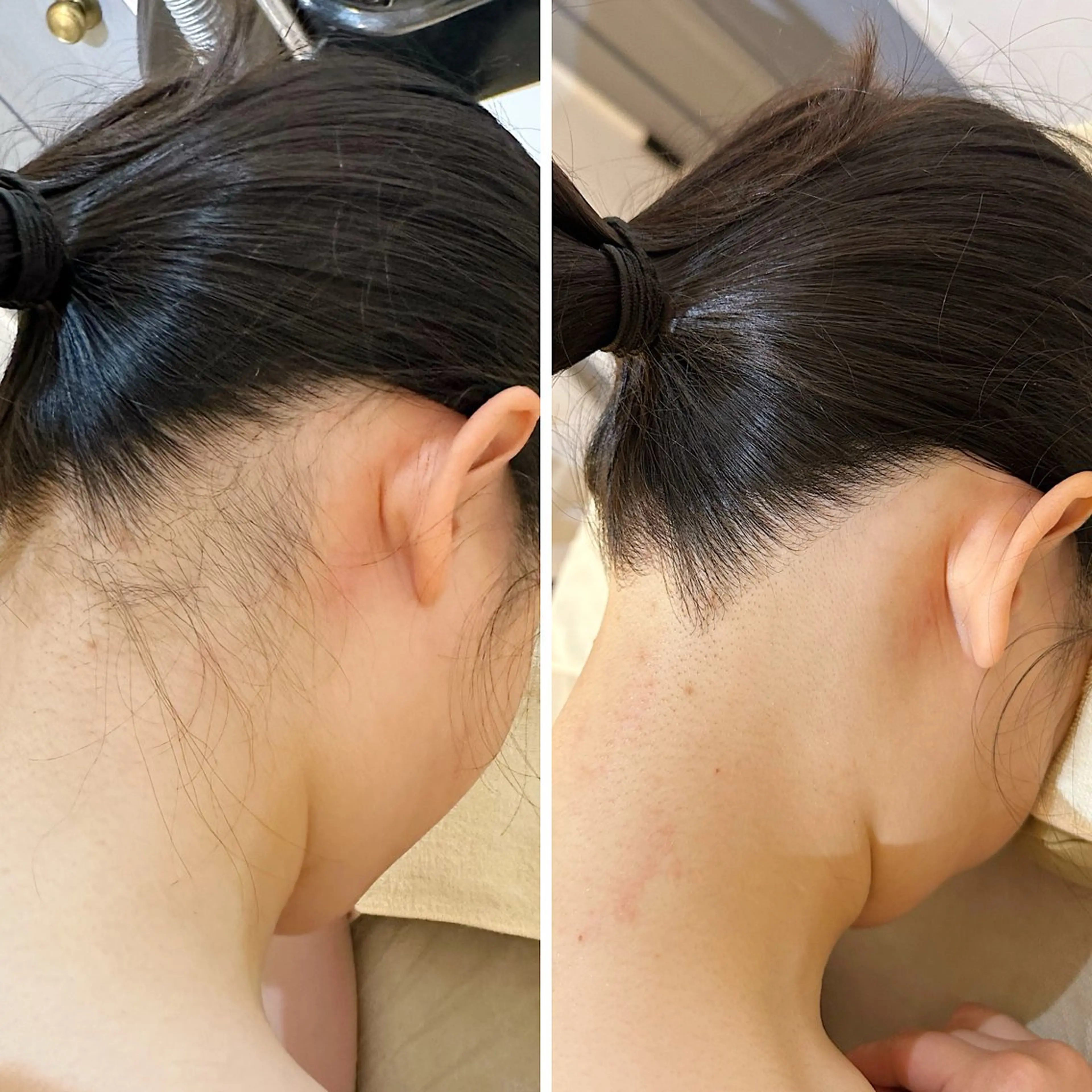 脱毛 うなじ脱毛/美肌脱毛 LABELのエステ・リラクイメージ