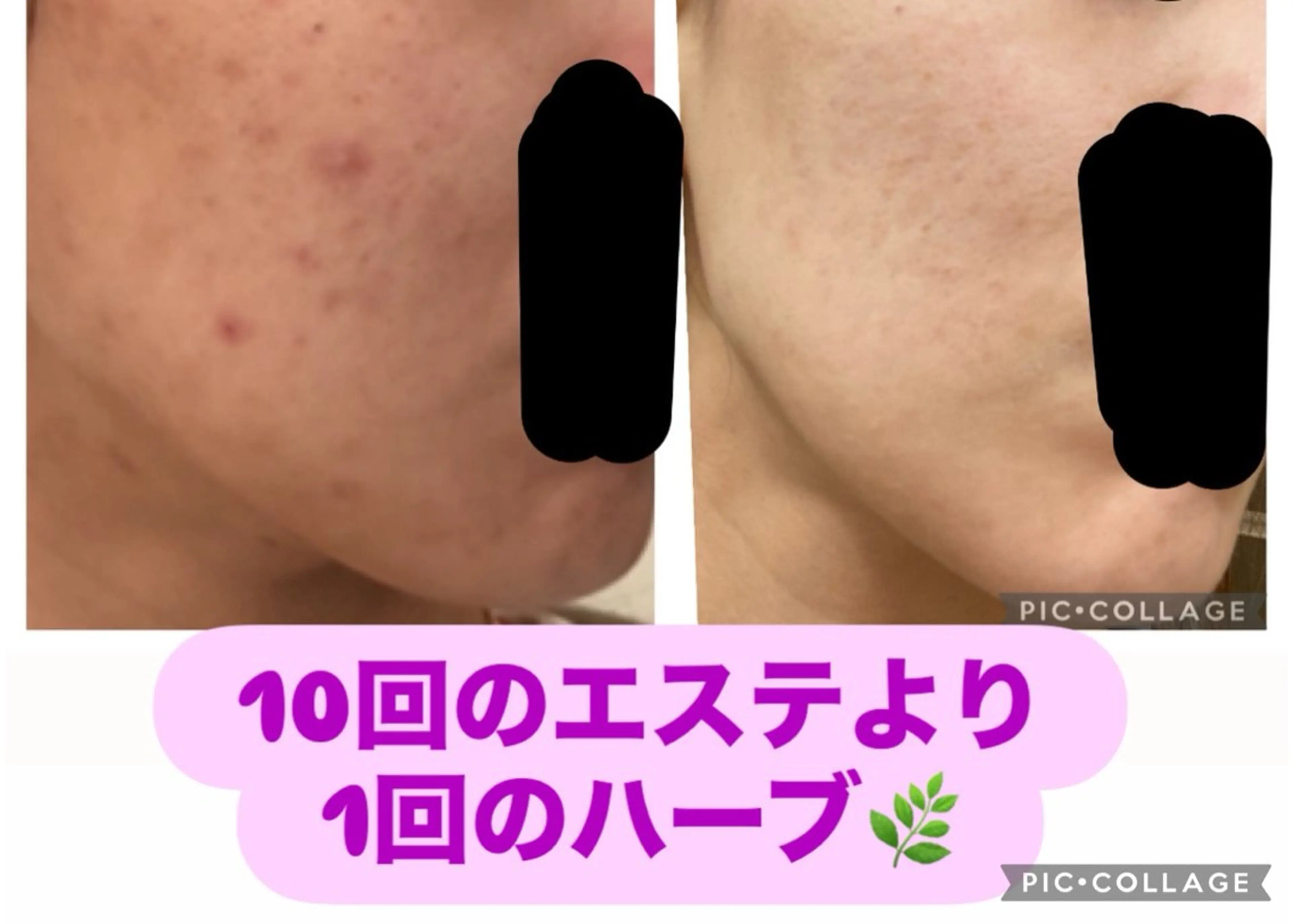 エステ リラク BeautySalonGemmy所属・Gemmy 愛美のエステ・リラクイメージ