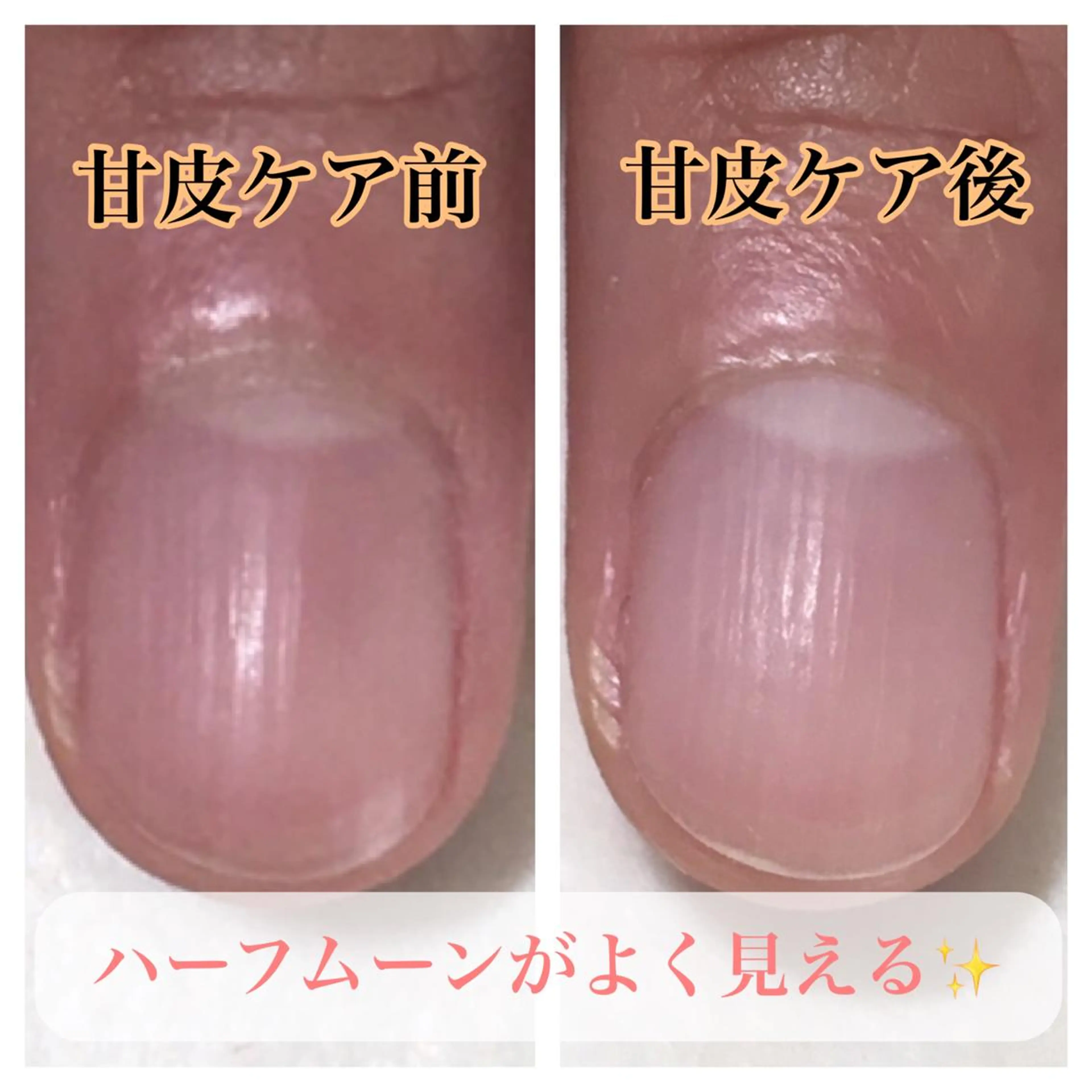 ネイル nailsalon Radditのネイルデザイン