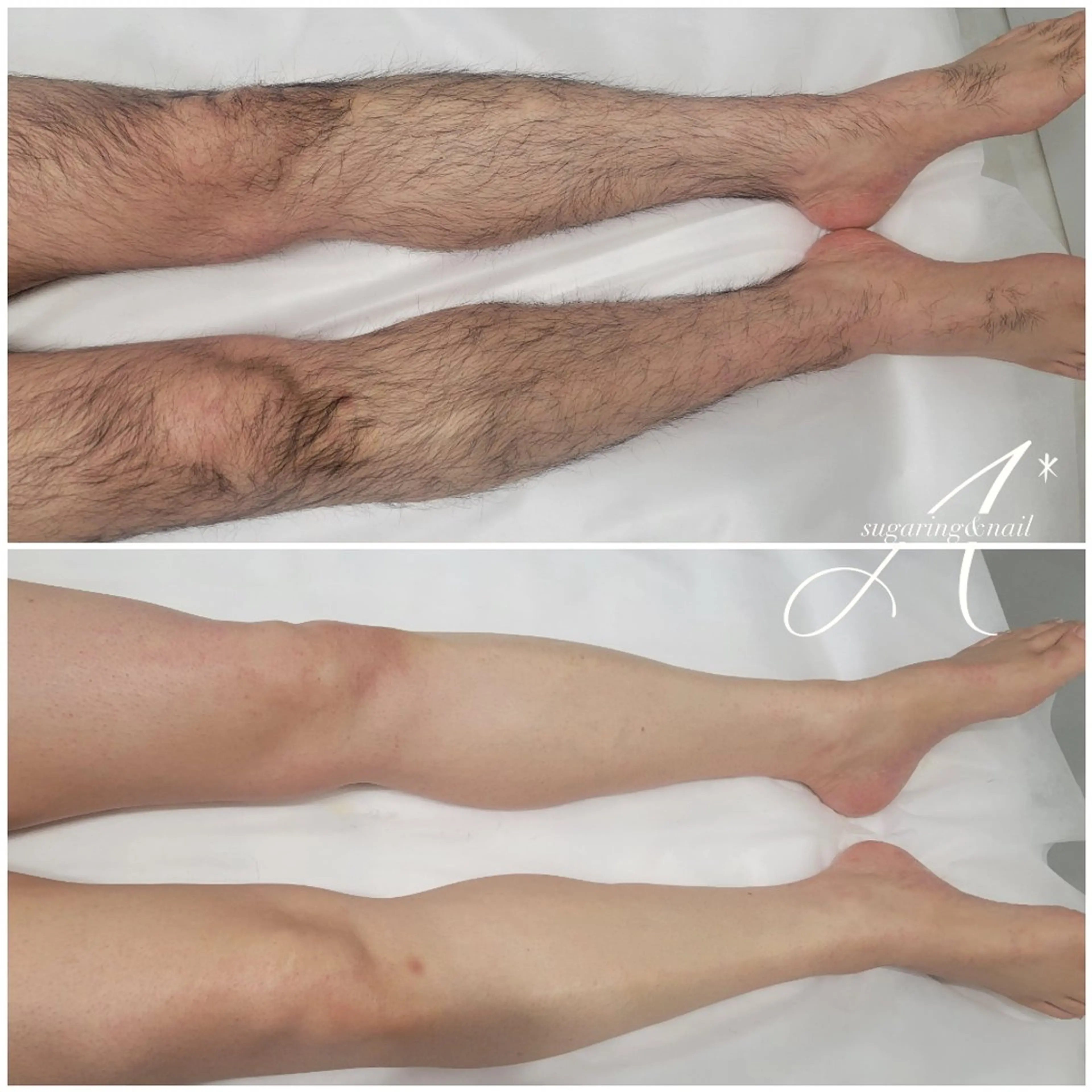 A*《エースター》 シュガーリング🍋のエステ・リラクイメージ