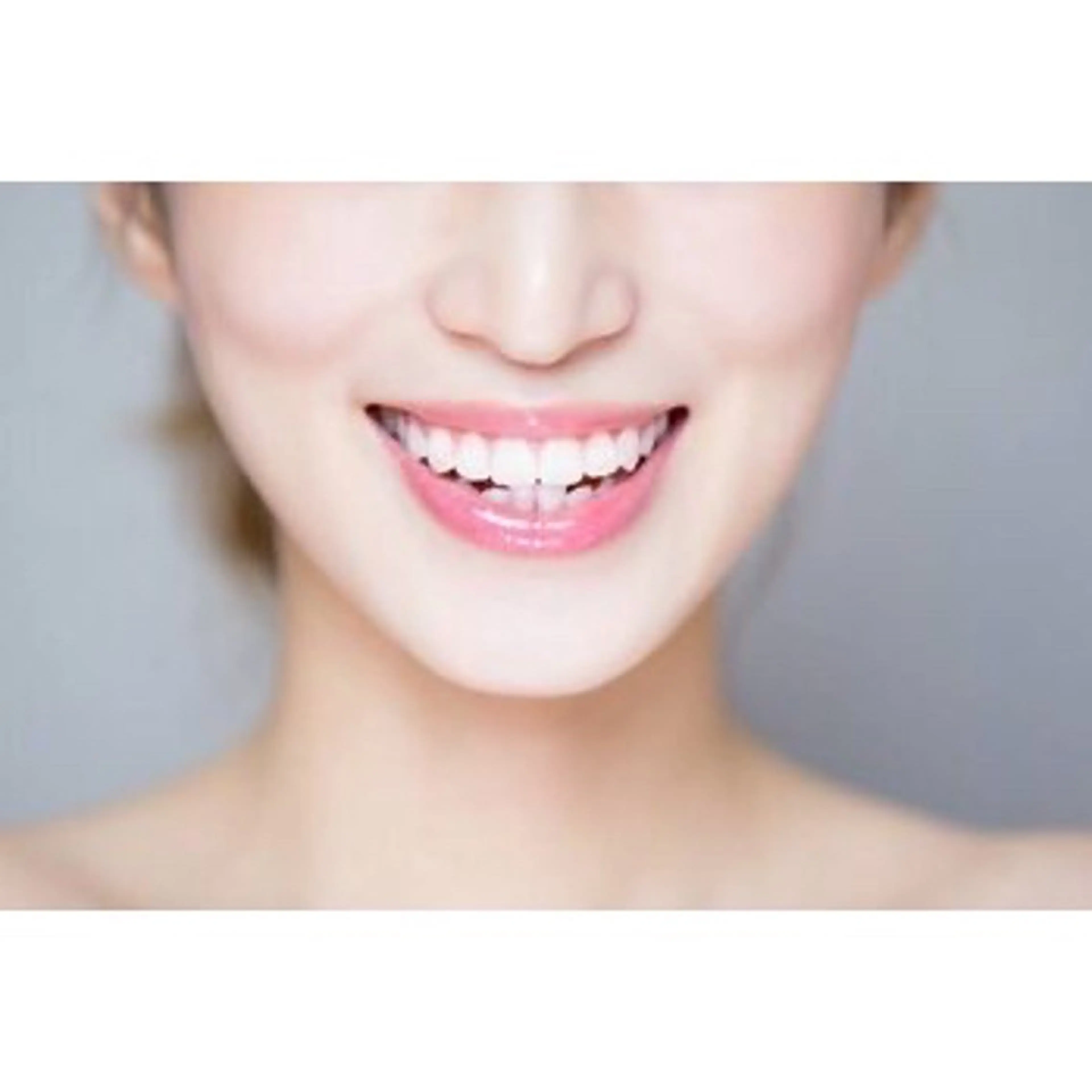 ペルラメディカル ホワイトニング名古屋のその他イメージ