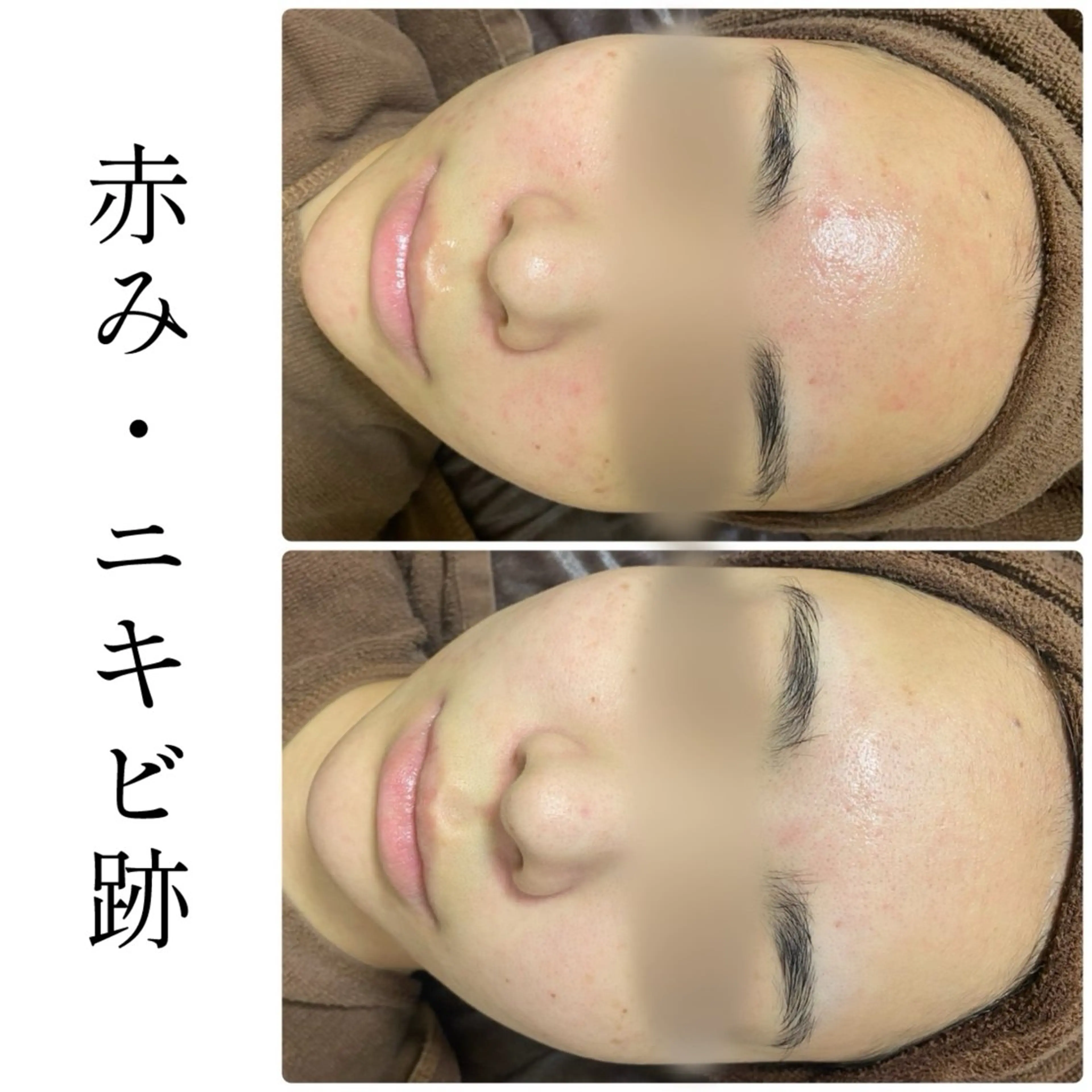 エステ ハーブピーリング専門 BIOEL横浜のエステ・リラクイメージ