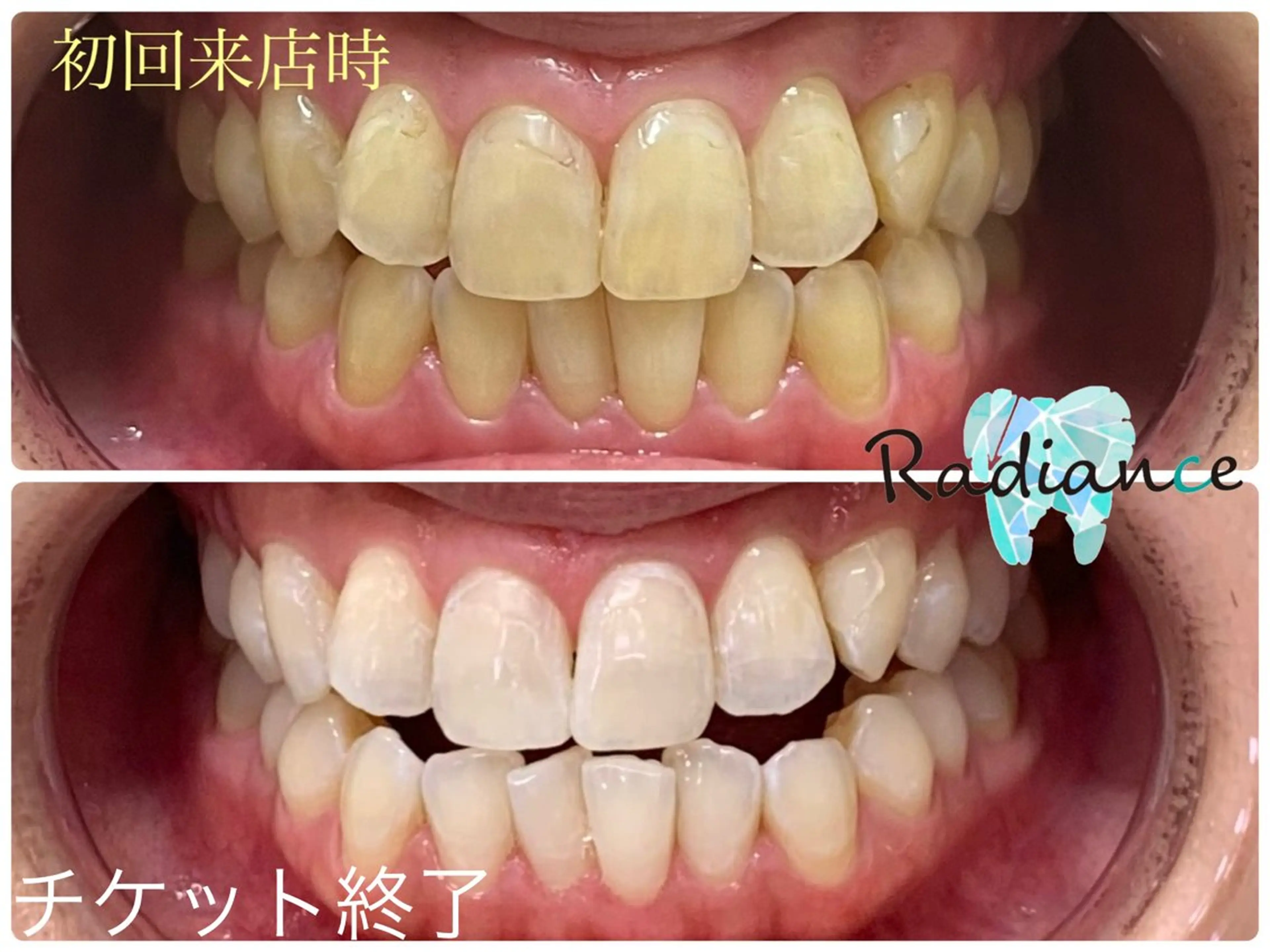 その他 札幌ホワイトニング ラディアンス札幌駅店のその他イメージ